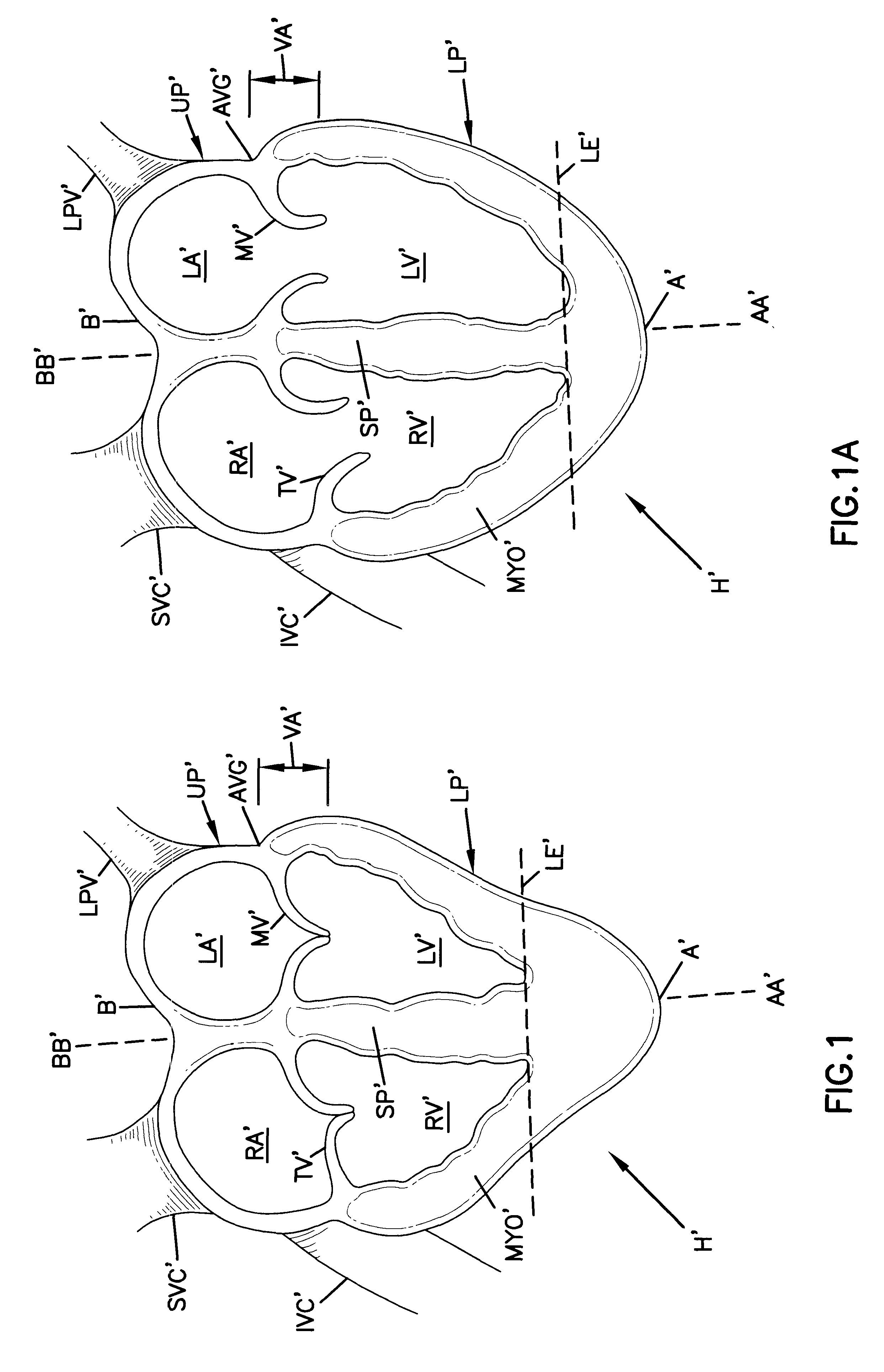 Device for heart measurement