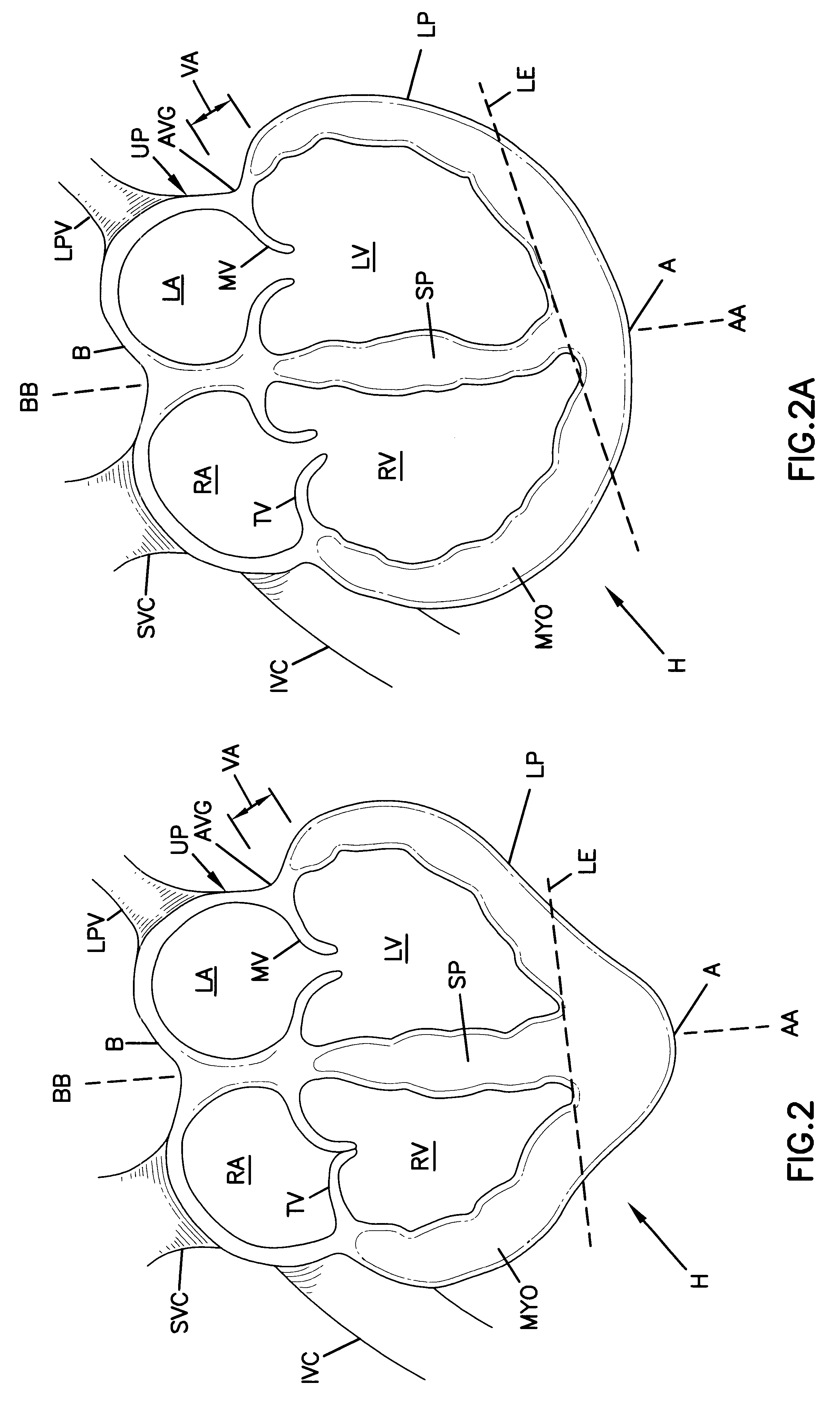 Device for heart measurement