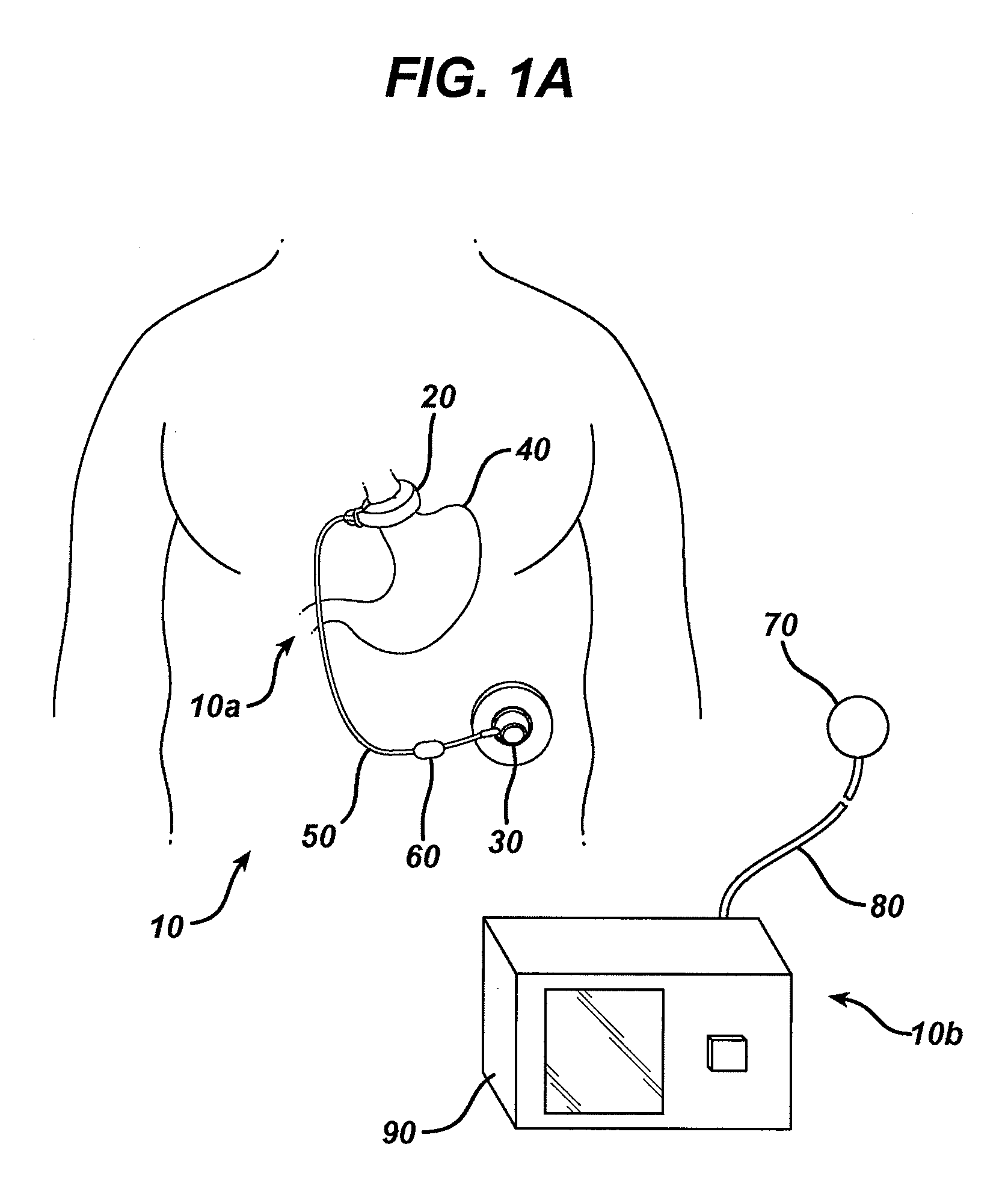 Gastric restriction device data handling devices and methods