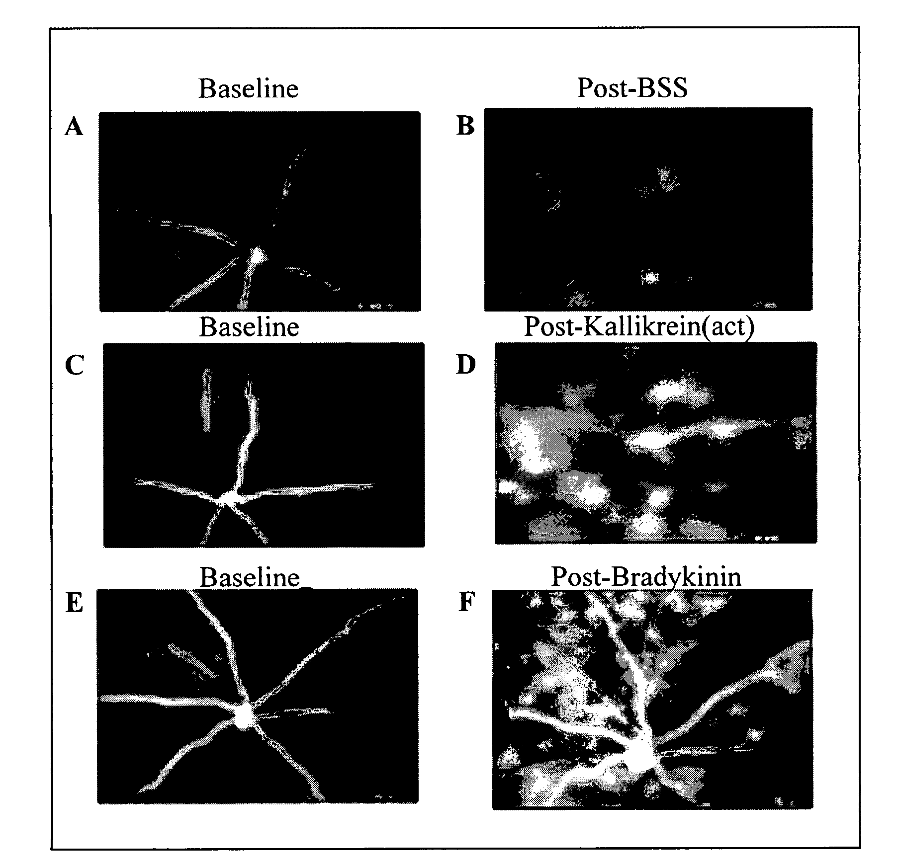 Methods for treatment of kallikrein-related disorders