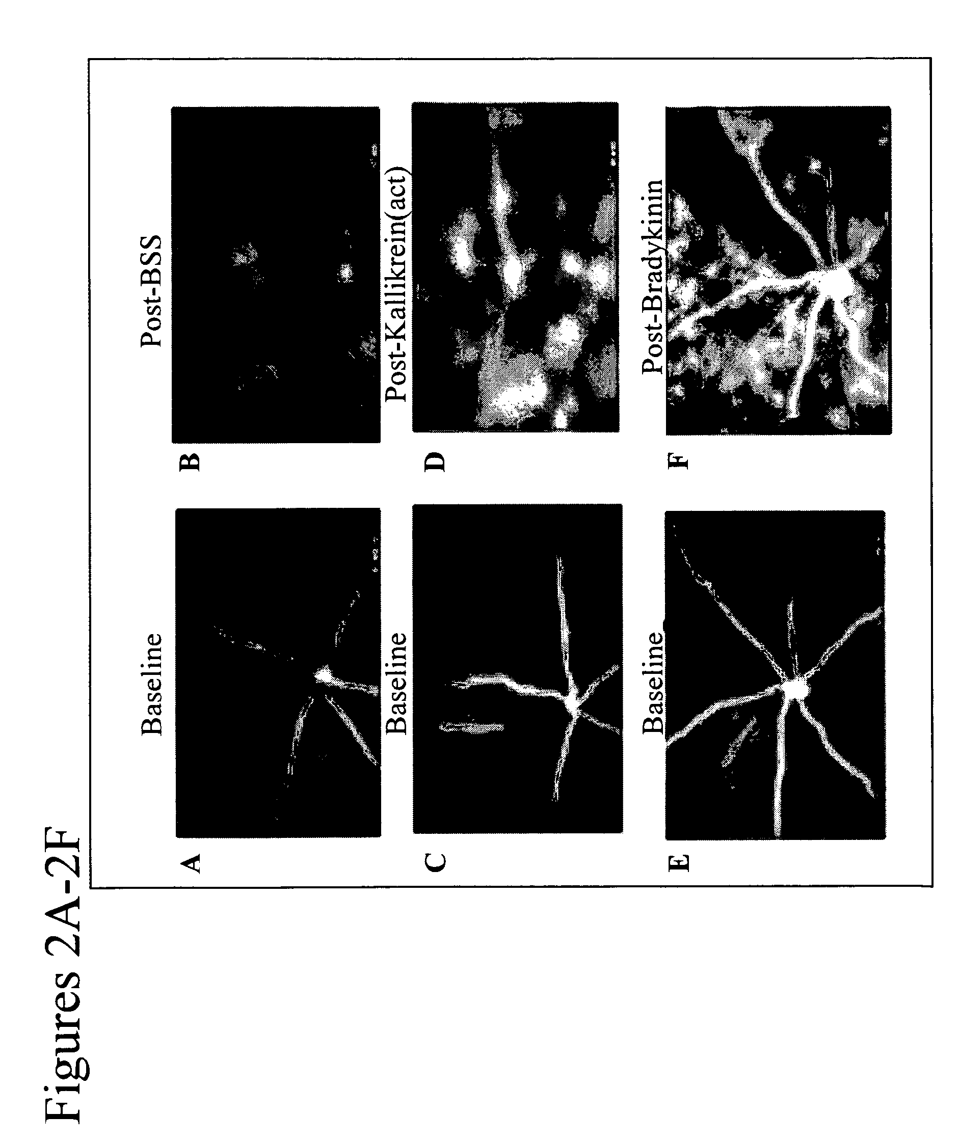 Methods for treatment of kallikrein-related disorders