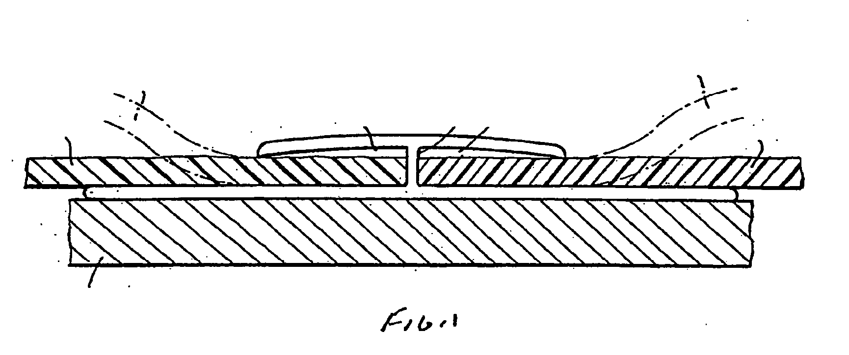 Dual-durometer divided bar