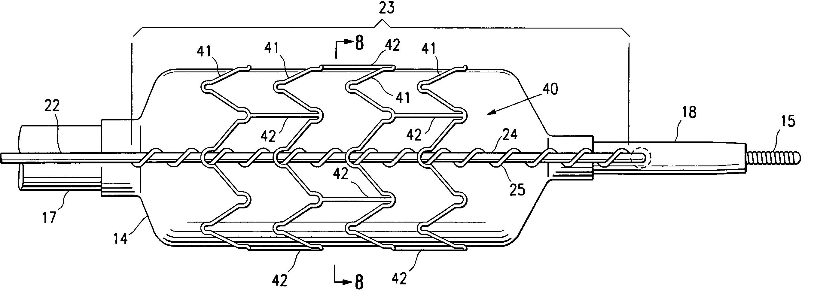 Balloon catheter having a textured member for enhancing balloon or stent retention