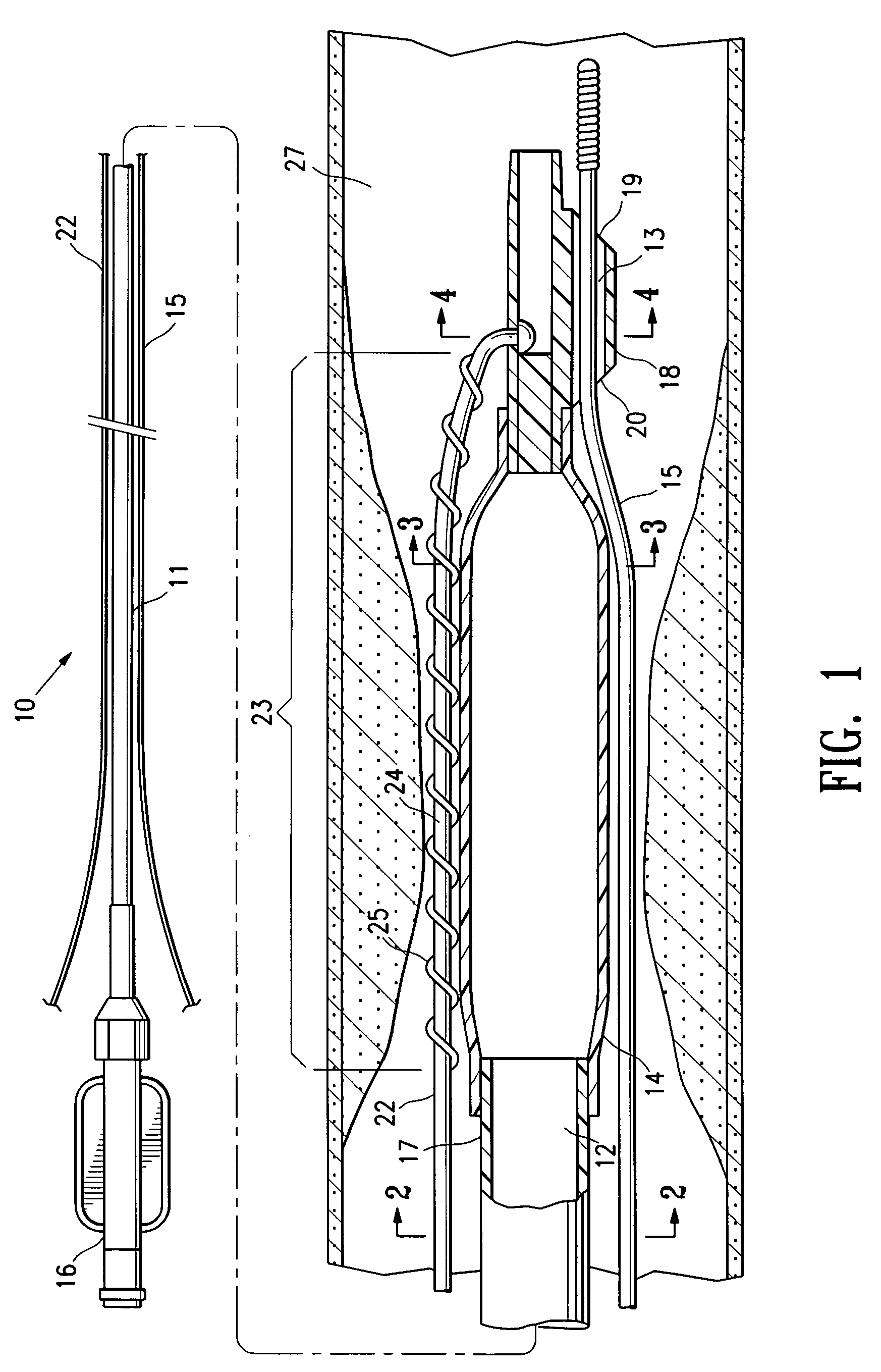 Balloon catheter having a textured member for enhancing balloon or stent retention