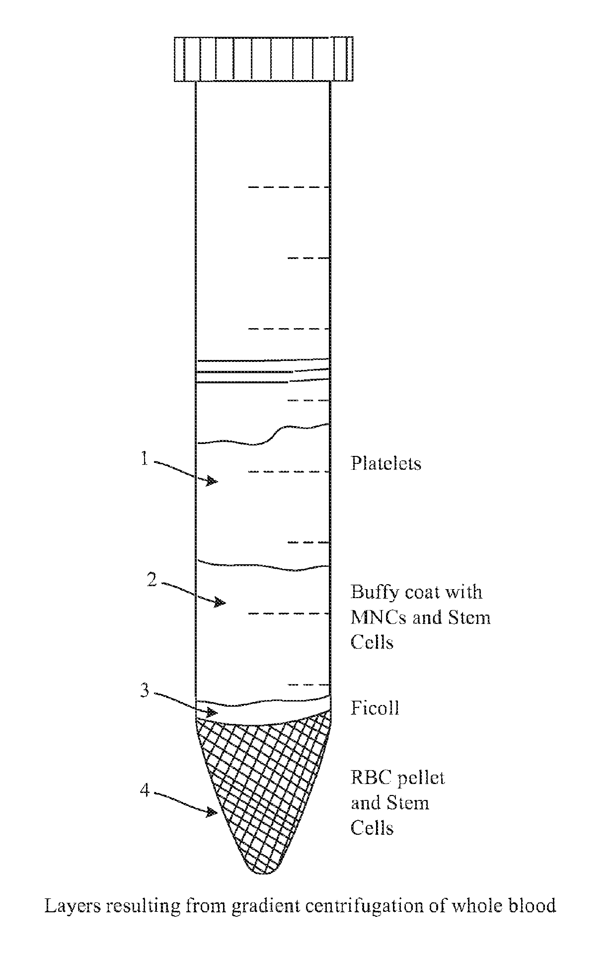 Compositions and methods to inhibit stem cell and progenitor cell binding to lymphoid tissue and for regenerating germinal centers in lymphatic tissues