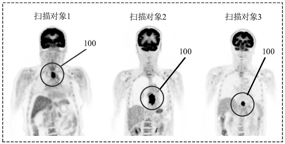 Imaging scanning protocol automatic planning method, device, electronic equipment and storage medium