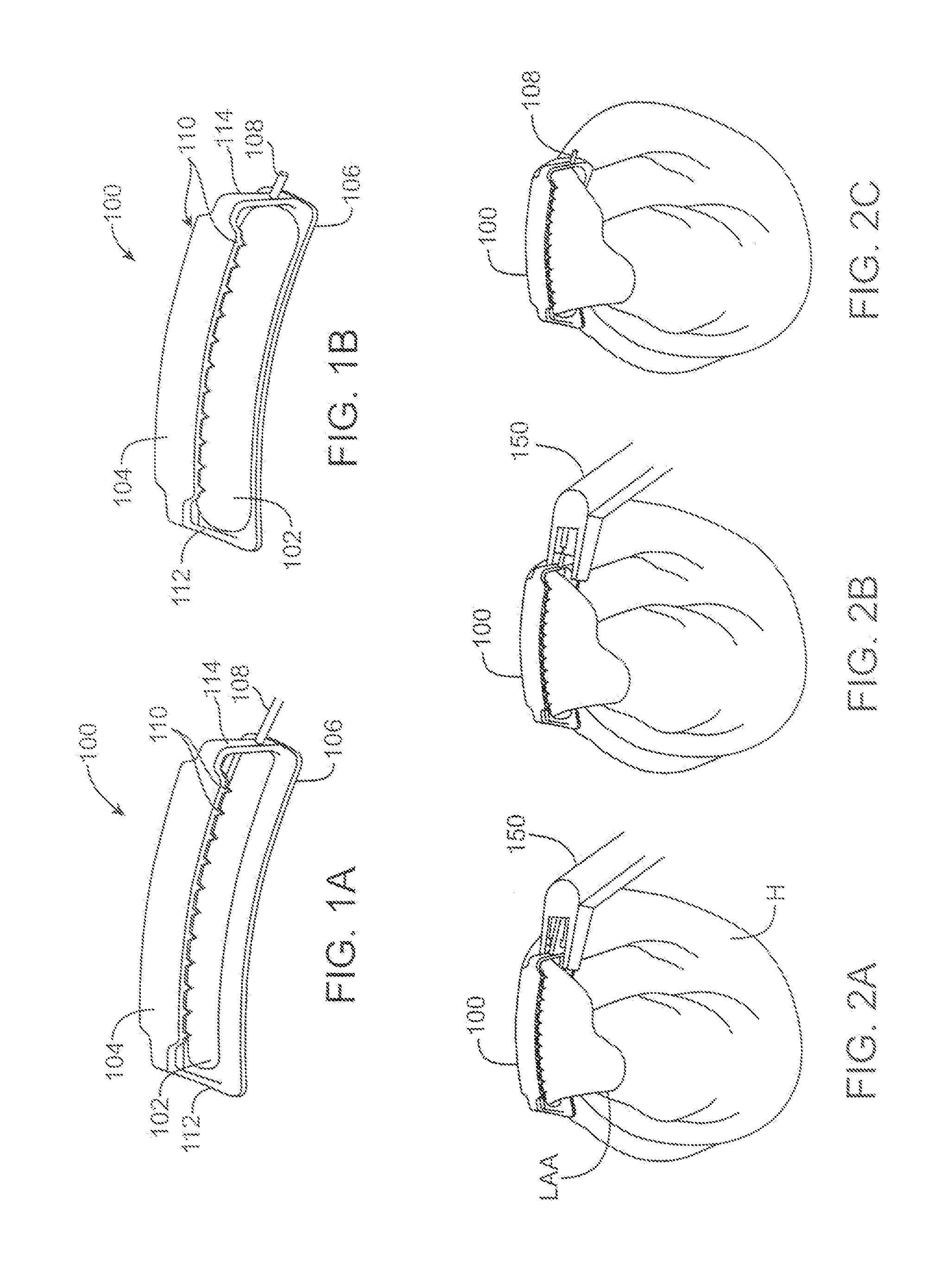 Left atrial appendage devices and methods