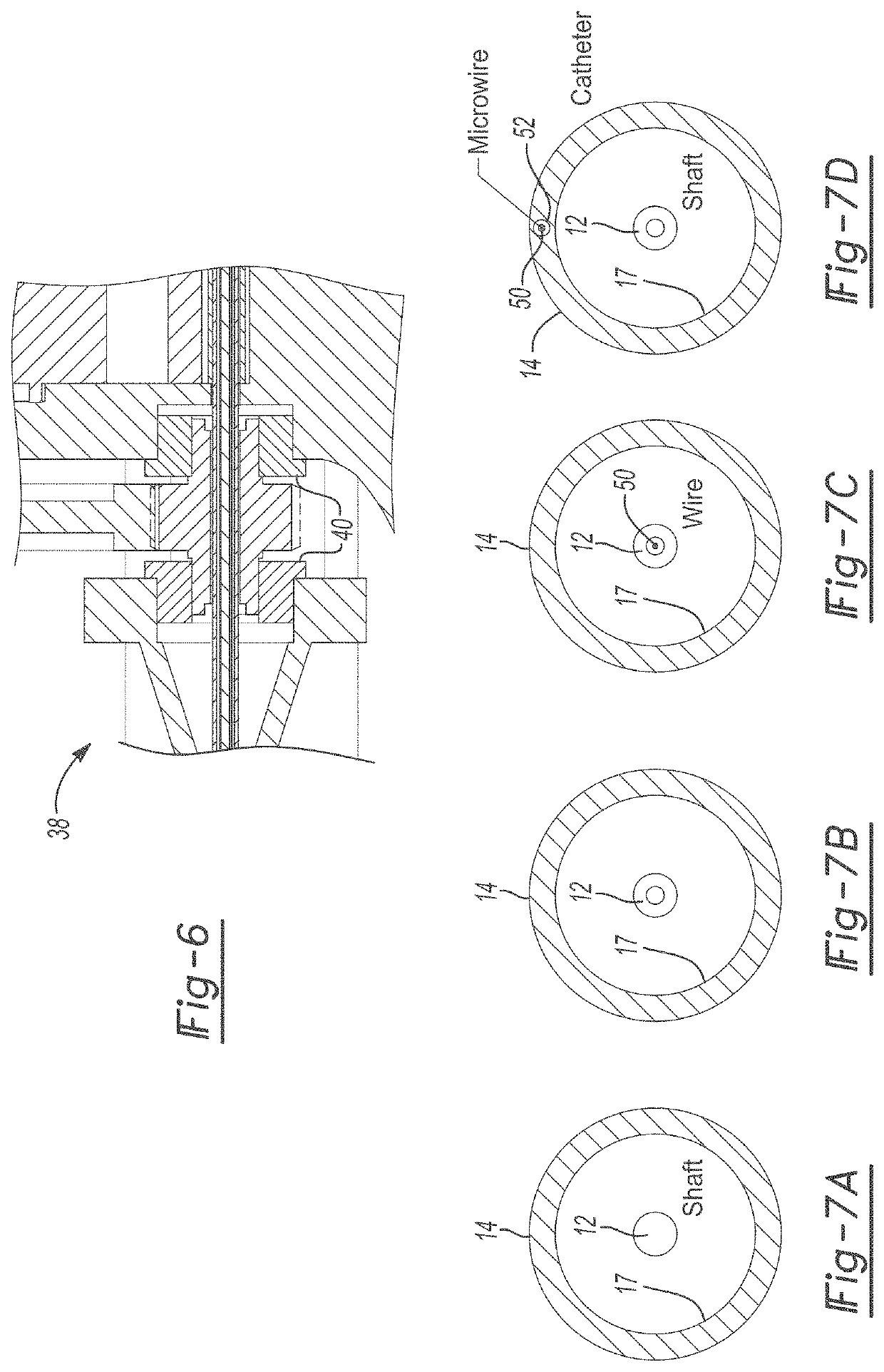 Hydrodynamic vortex aspiration catheter