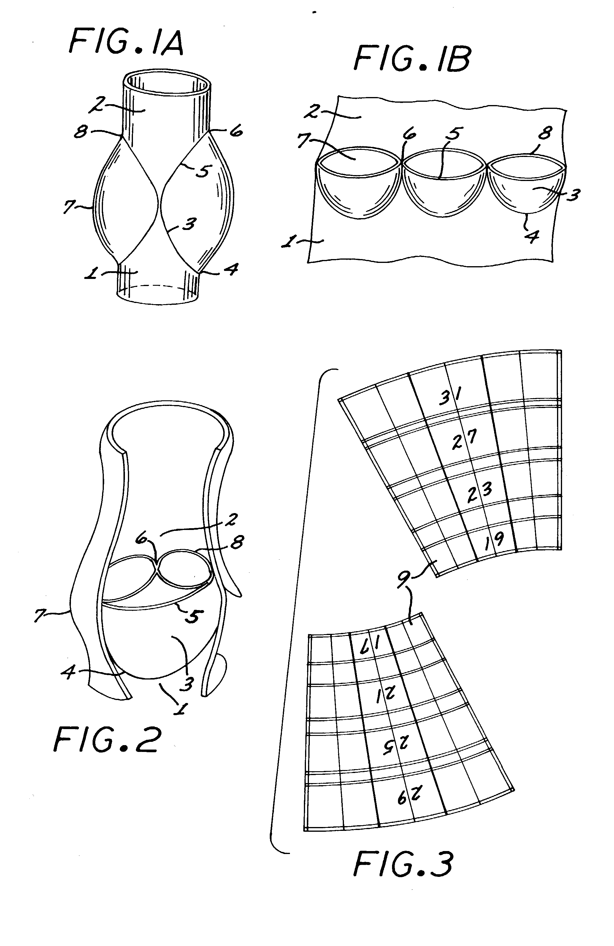 Reed valve for implantation into mammalian blood vessels and heart with optional temporary or permanent support