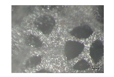 Preparation method of porous tantalum serving as medical metal implant material