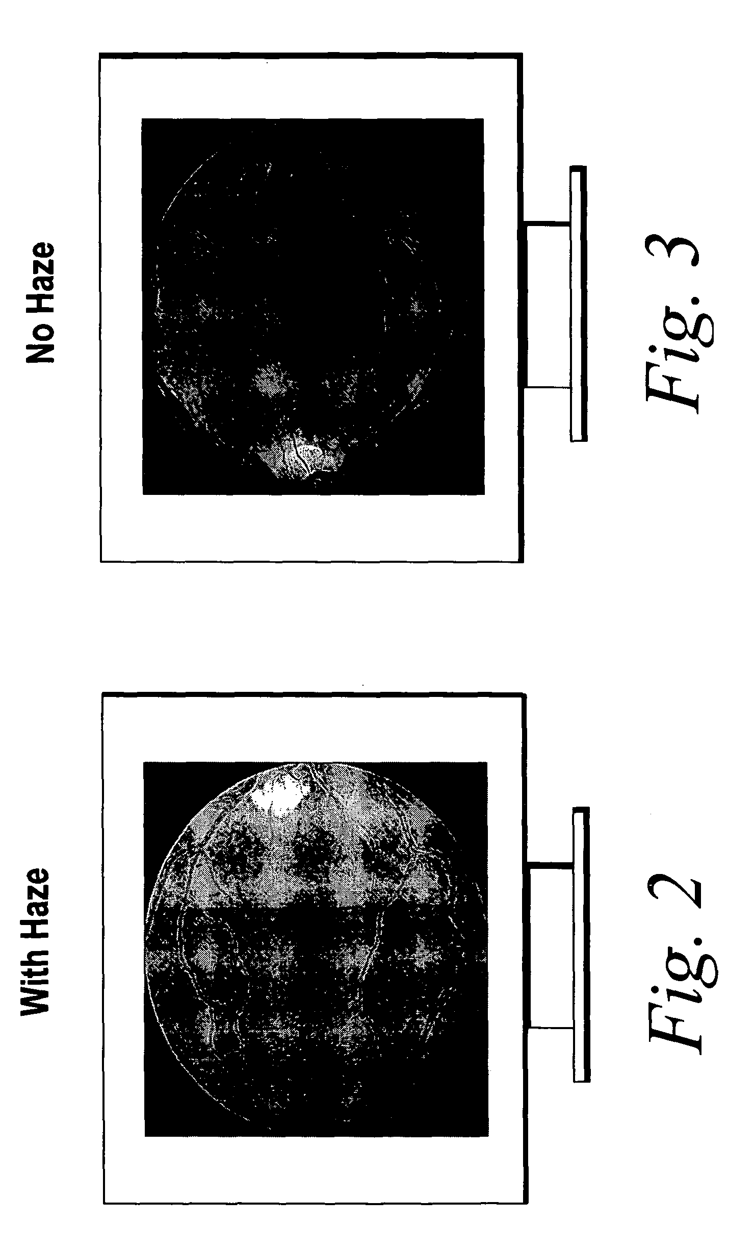 Haze reduction method and apparatus for use in retinal imaging