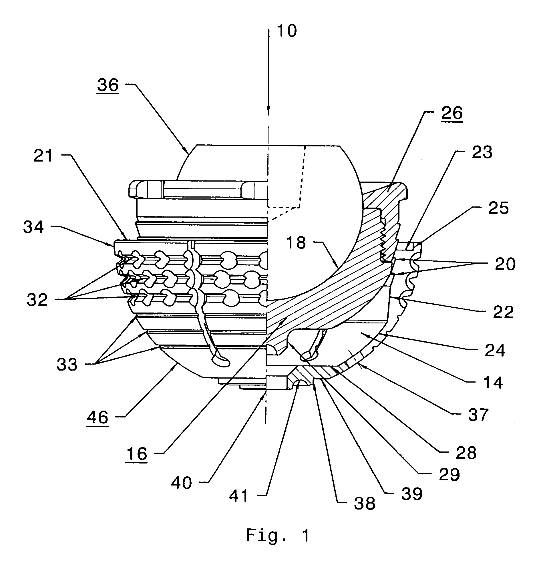 Expandable, supporting acetabular cup