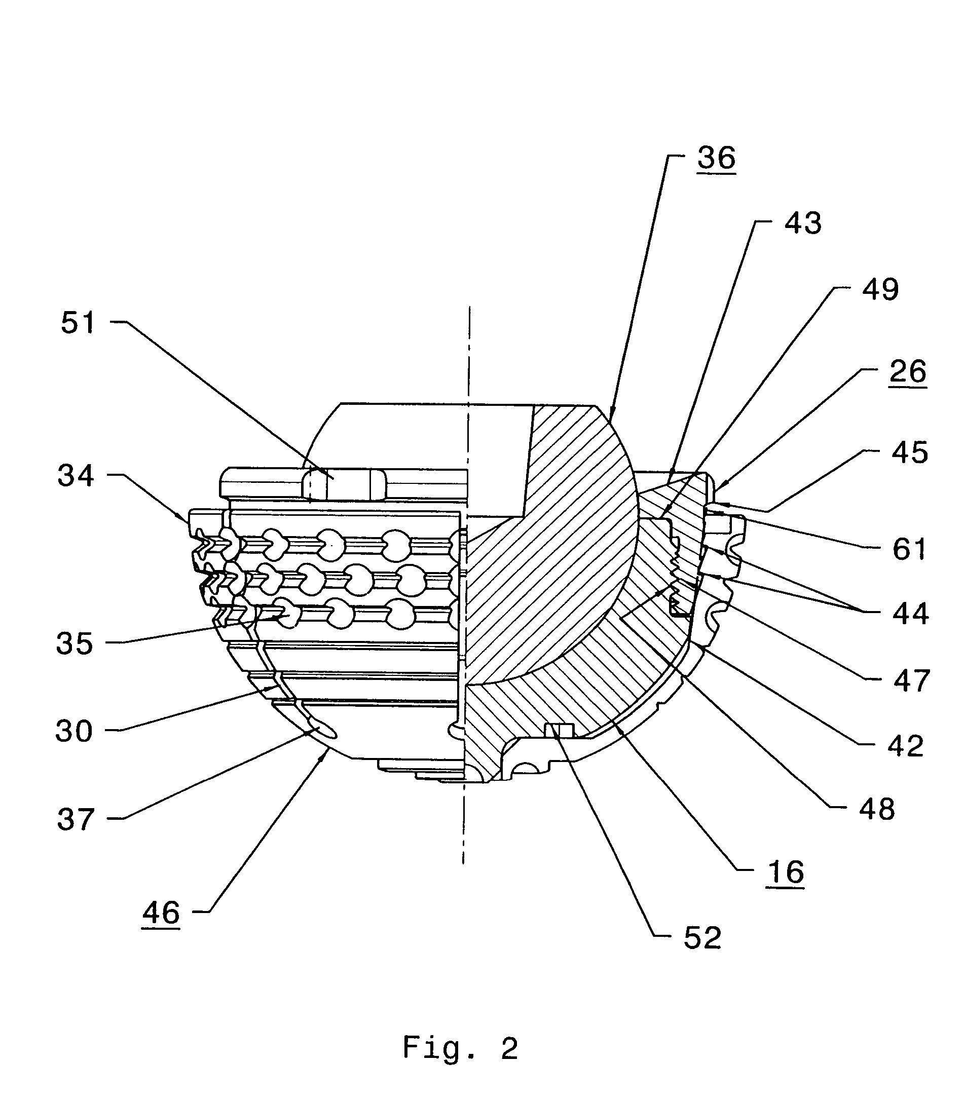 Expandable, supporting acetabular cup