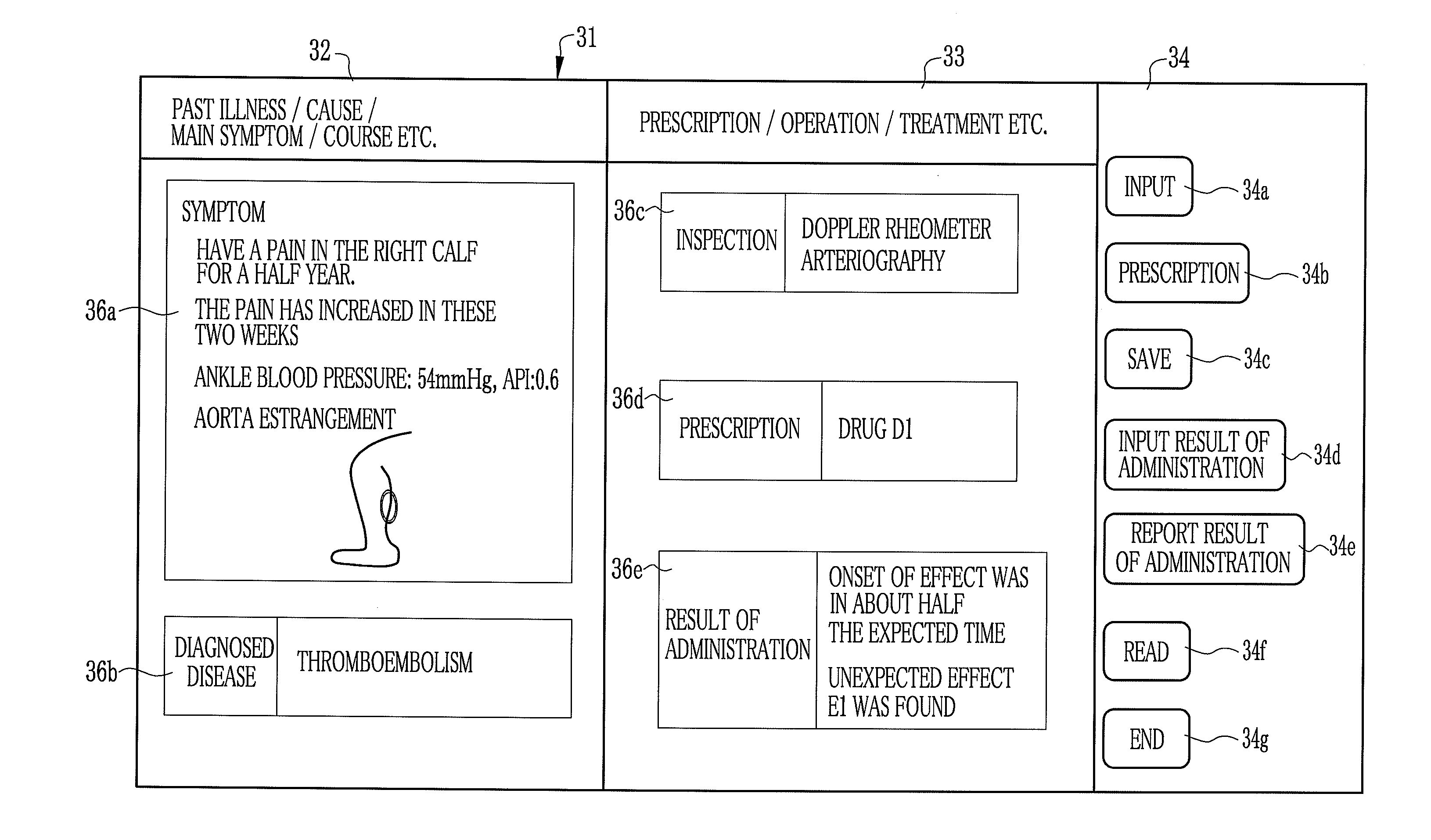 Drug information collecting network system and electronic chart apparatus