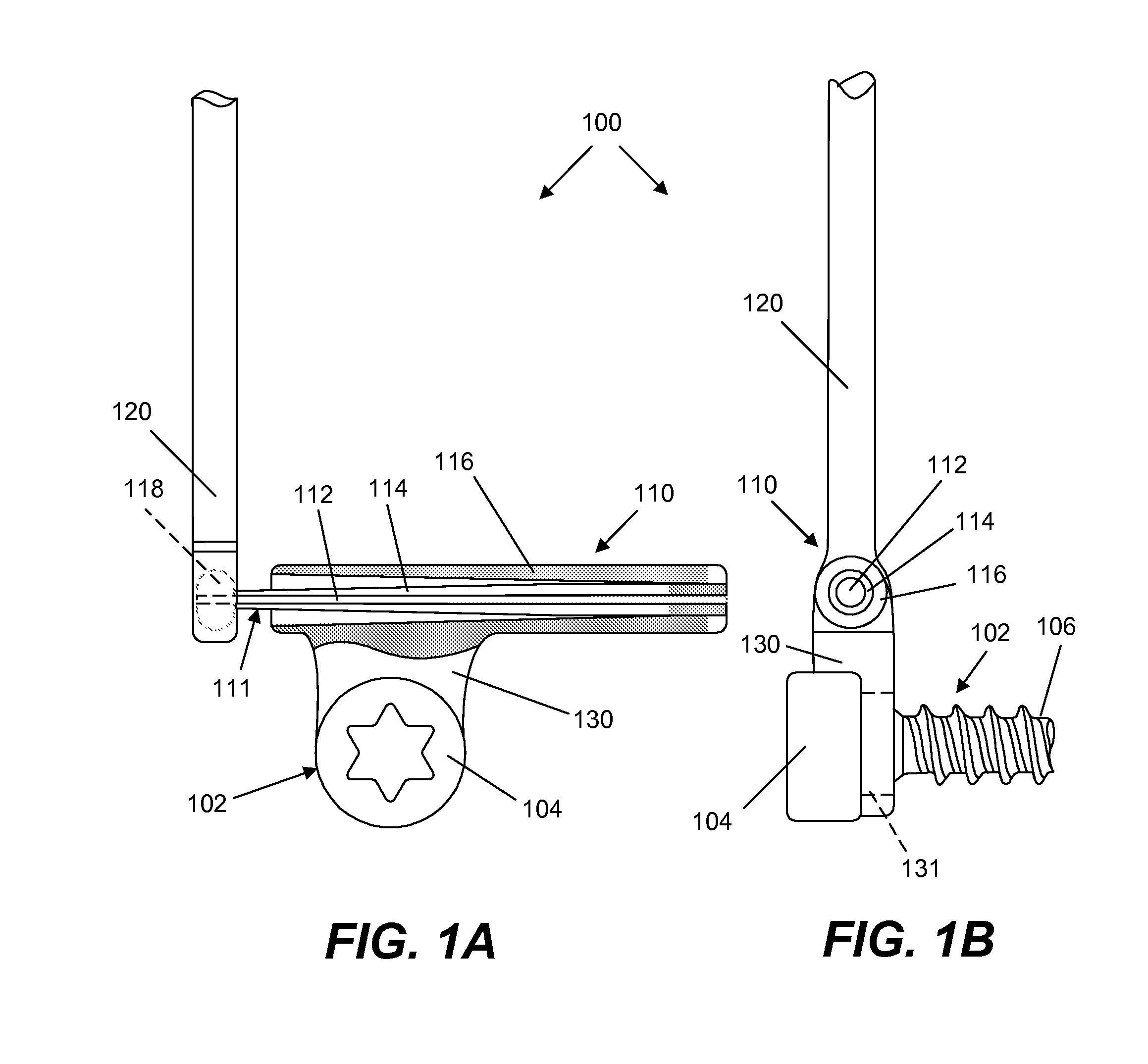 Spine implant with a dual deflection rod system including a deflection limiting sheild associated with a bone screw and method