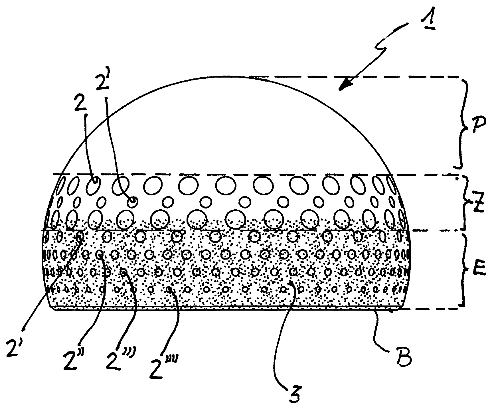 Ball joint or cap implant for an artificial hip joint