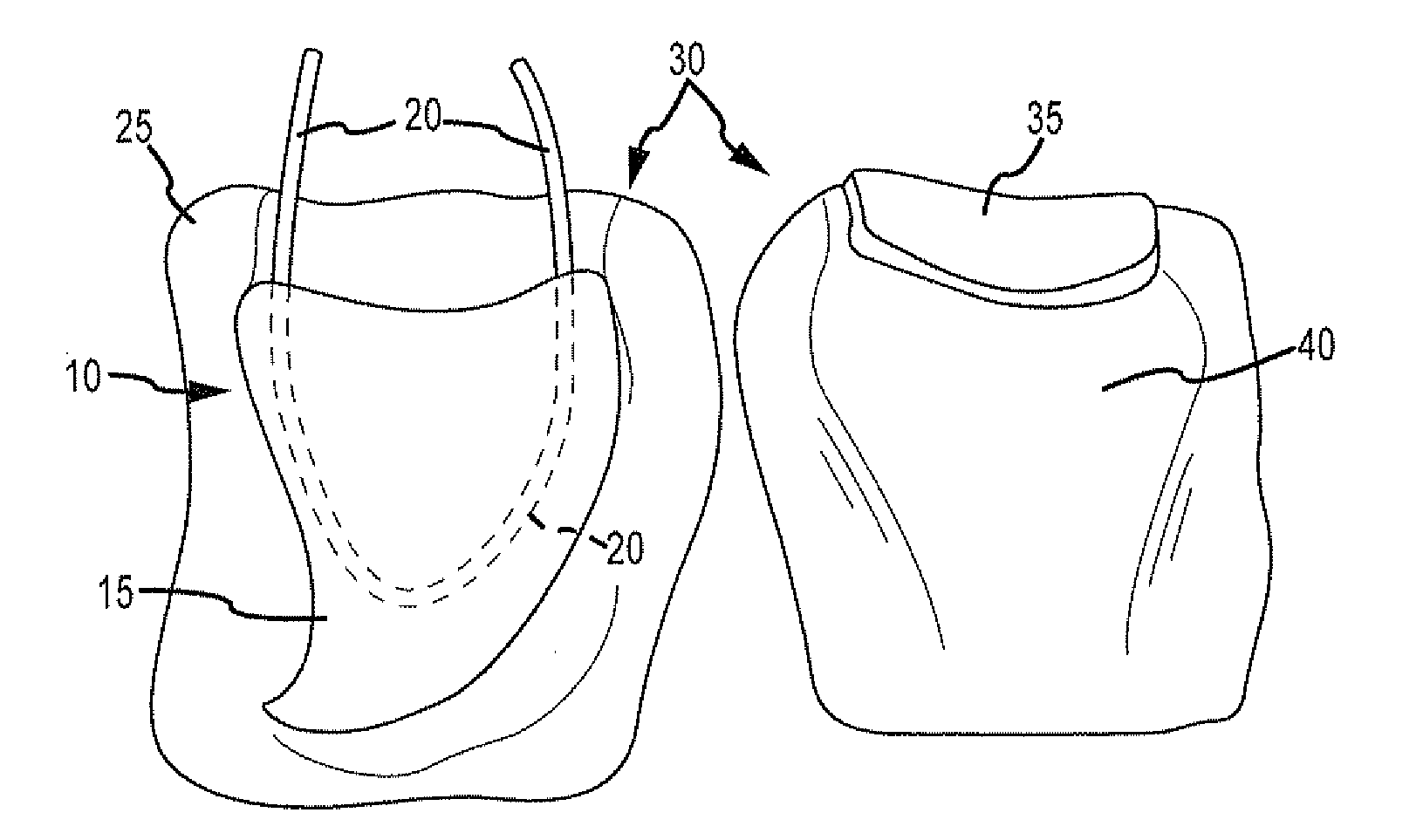 Surgical simulator, simulated organs and method of making same