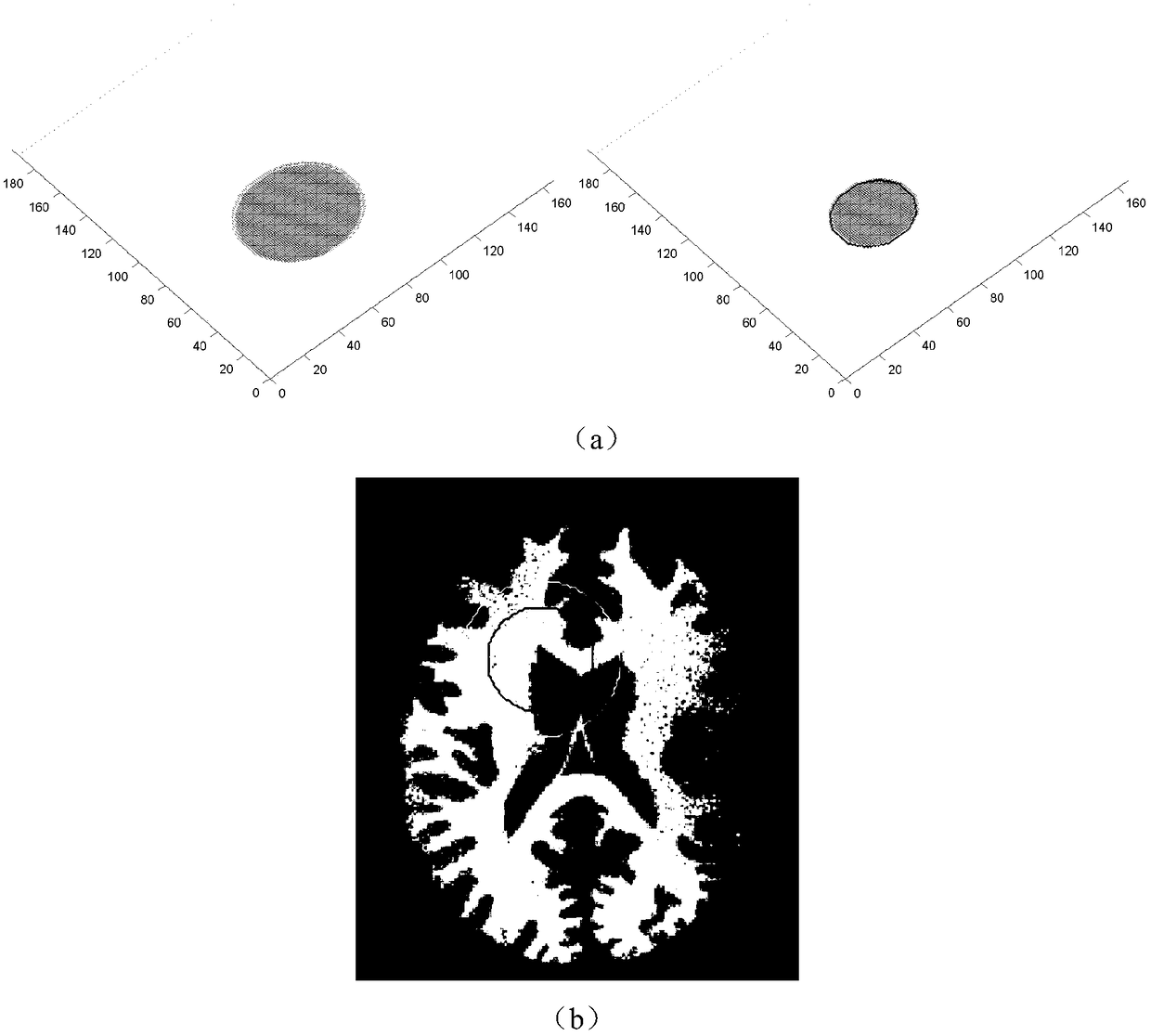 An Image Level Set Segmentation Method Based on Local Gray Clustering Features