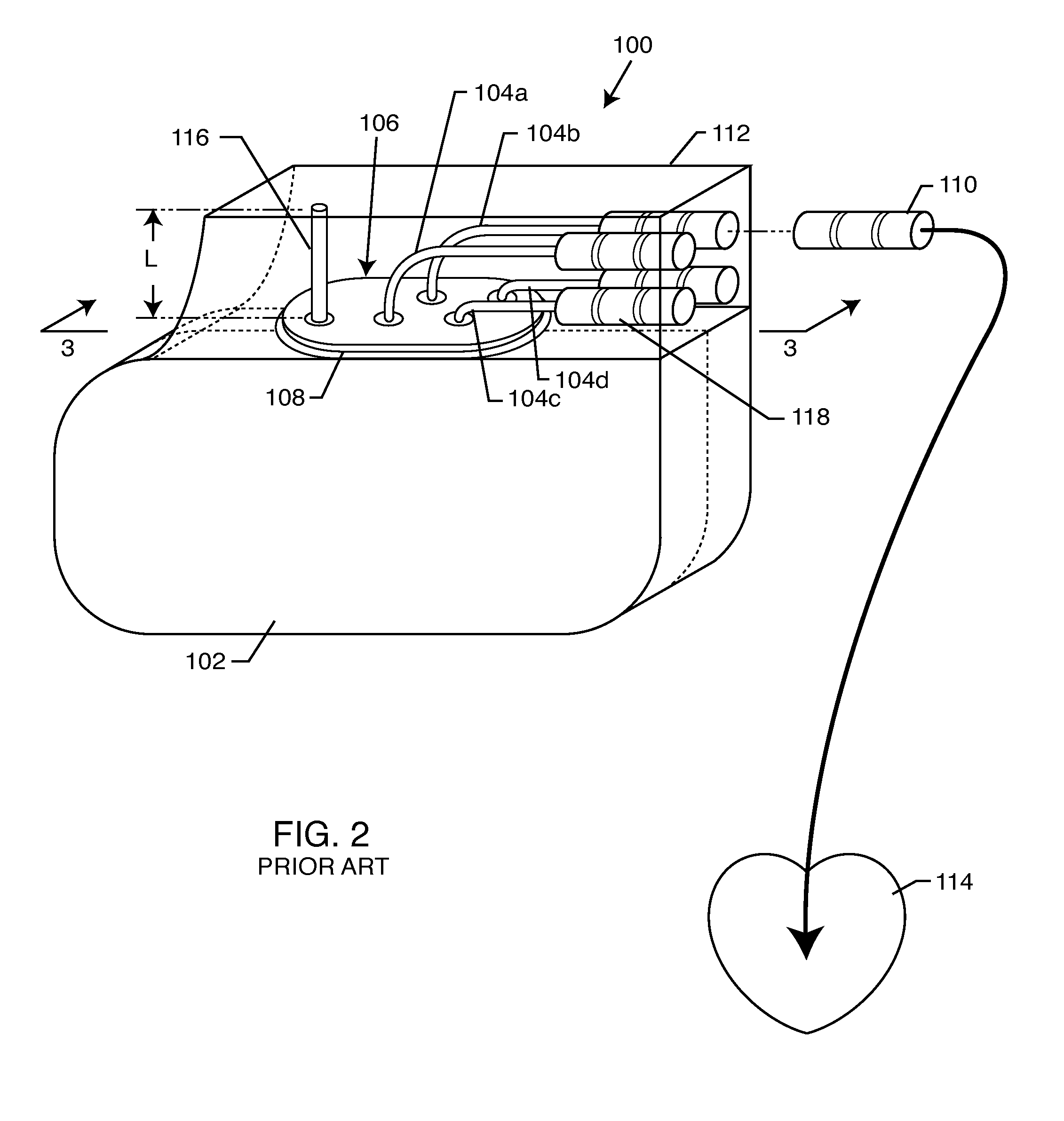 Header embedded filter for implantable medical device