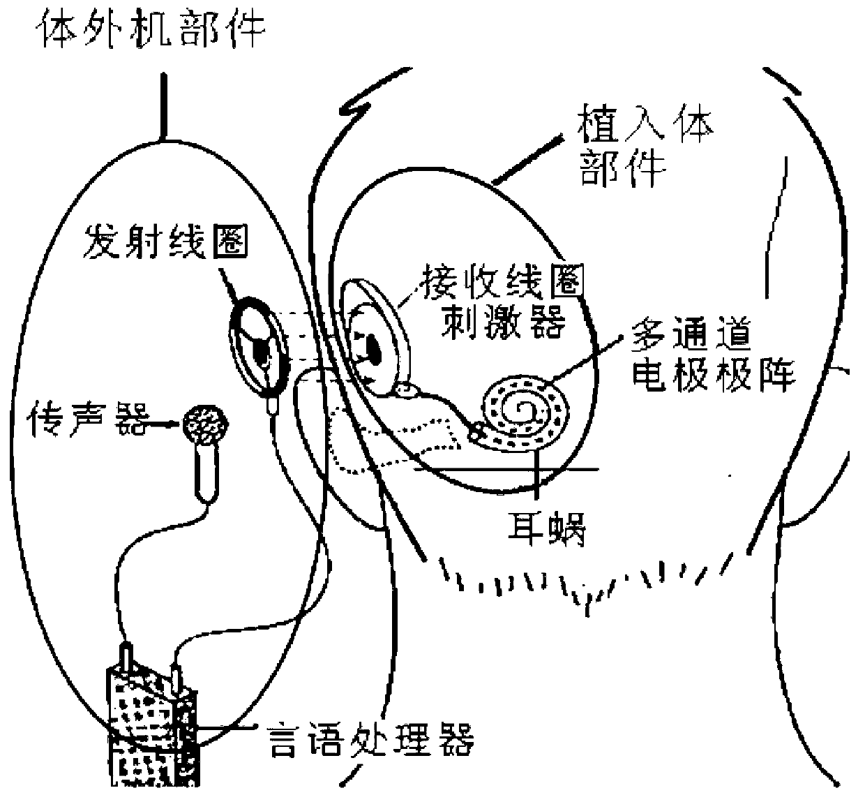 Method and system for processing signal of channel self-adaptation dynamic peak artificial cochlea