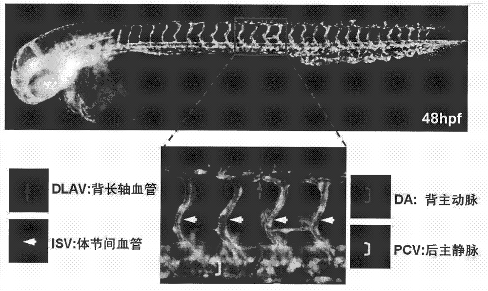 Anti-angiogenic compound and usage thereof