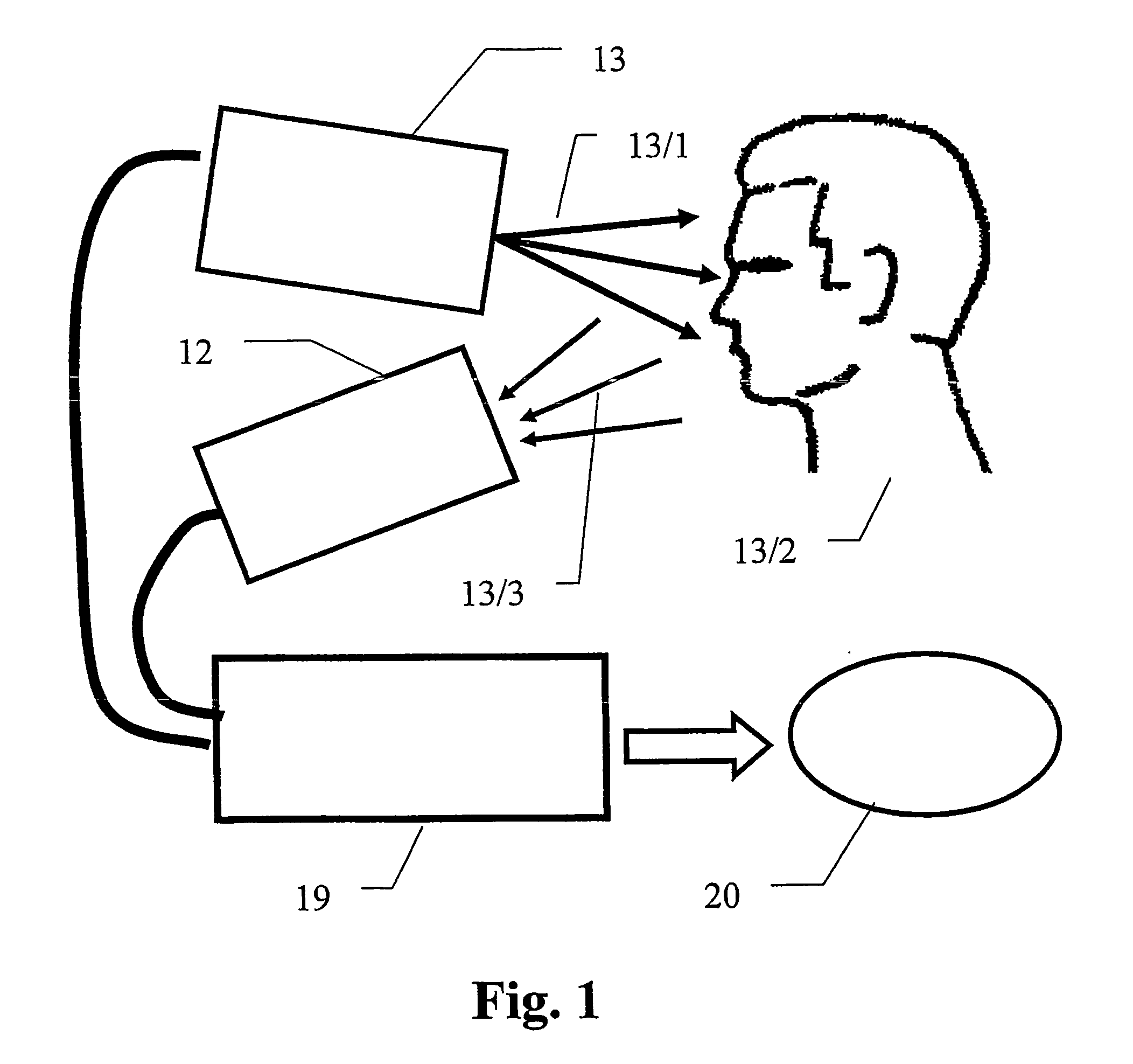 Color edge based system and method for determination of 3d surface topology