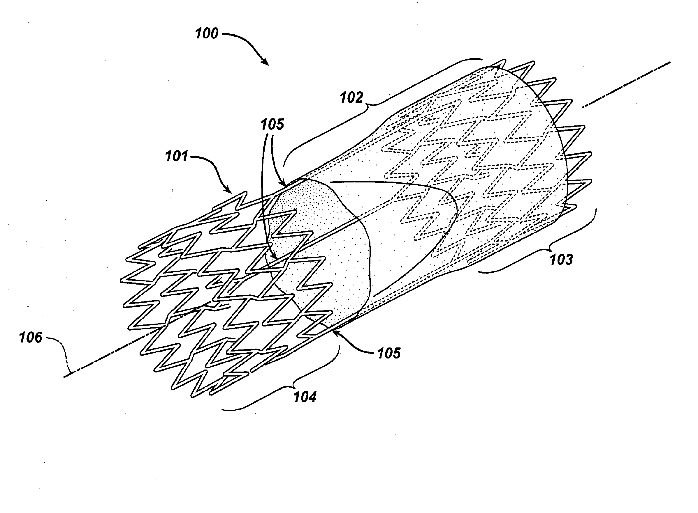 Method of forming a tubular membrane on a structural frame