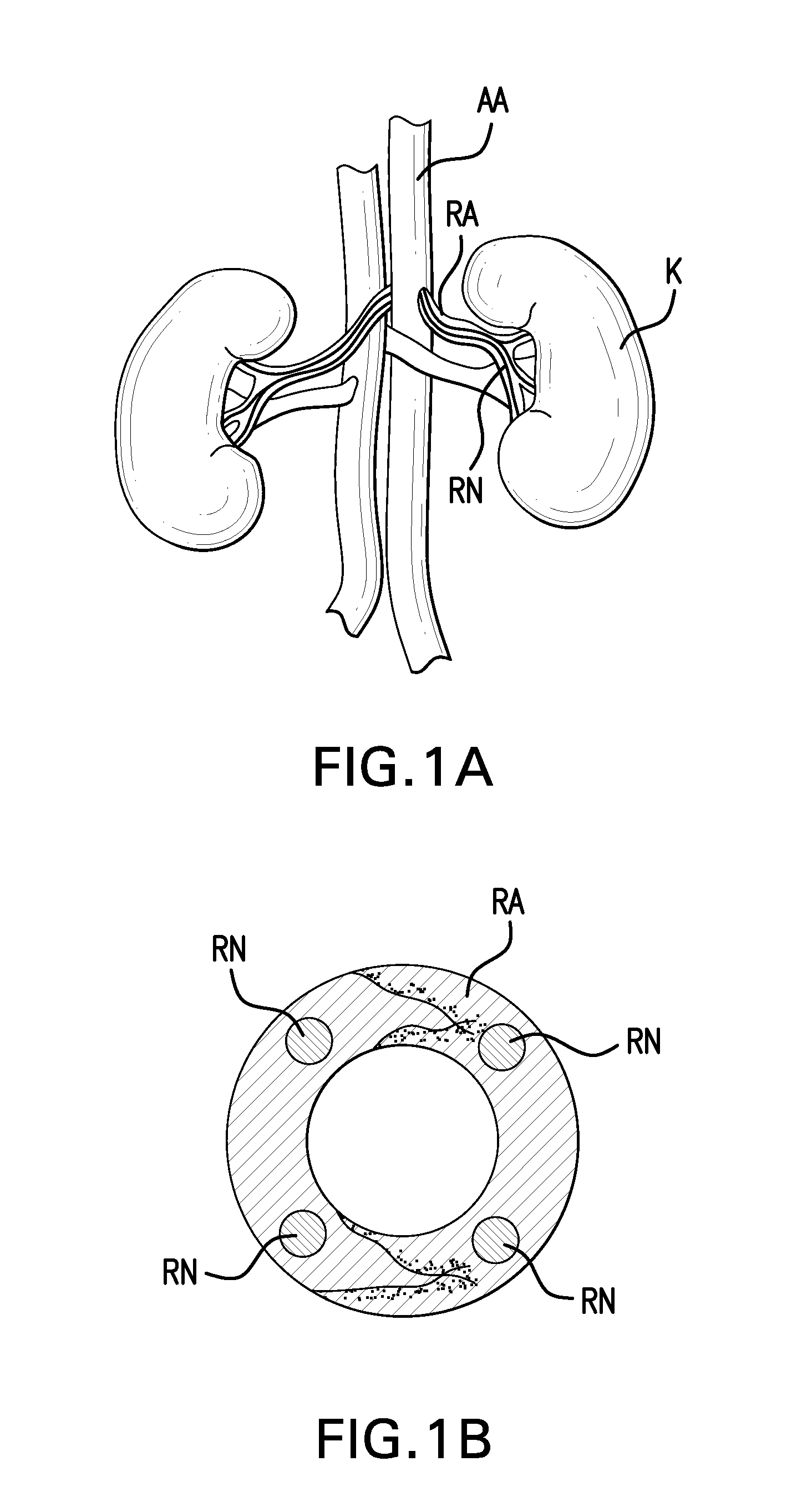 Agents and methods for denervation