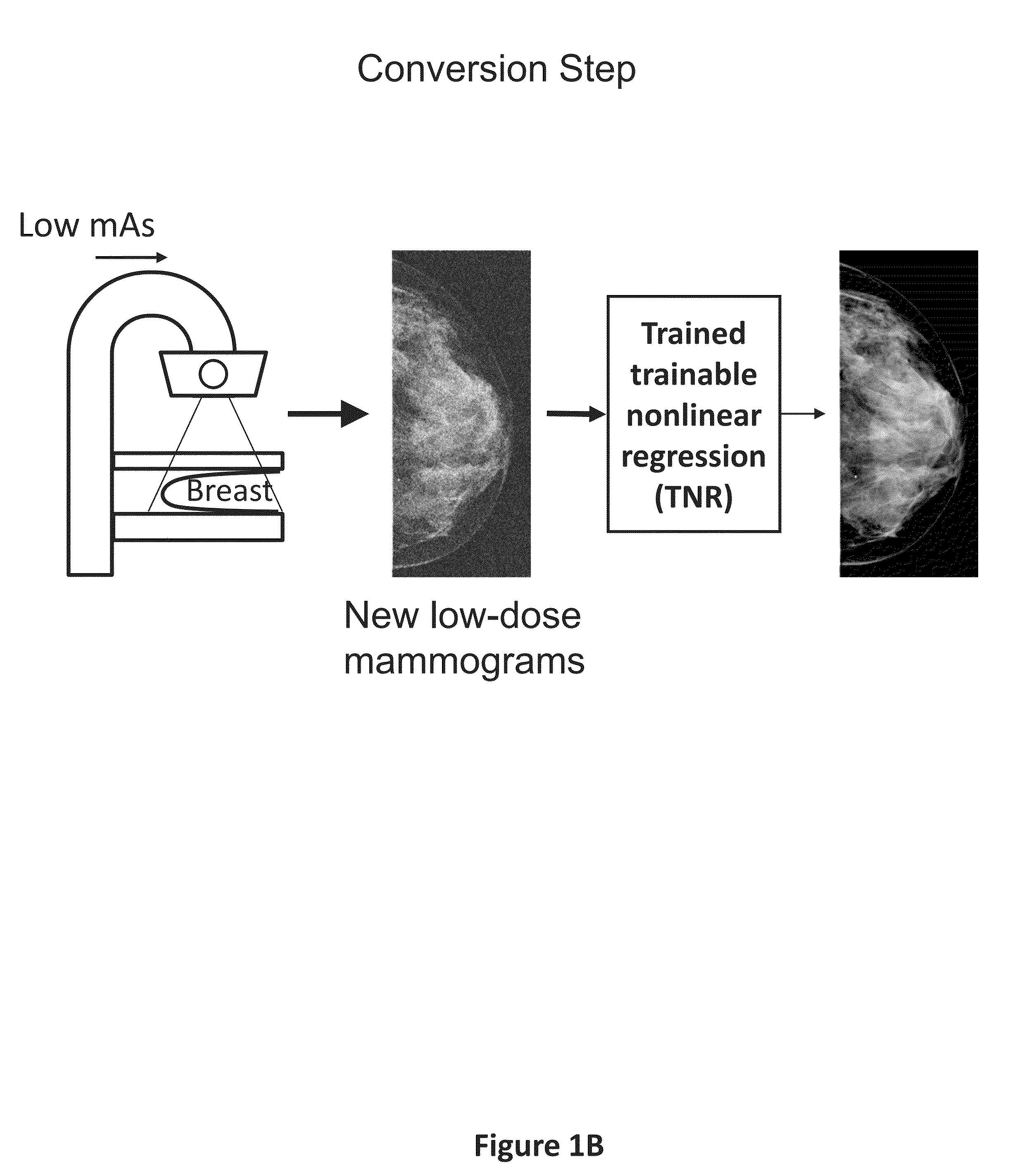 Converting low-dose to higher dose mammographic images through machine-learning processes