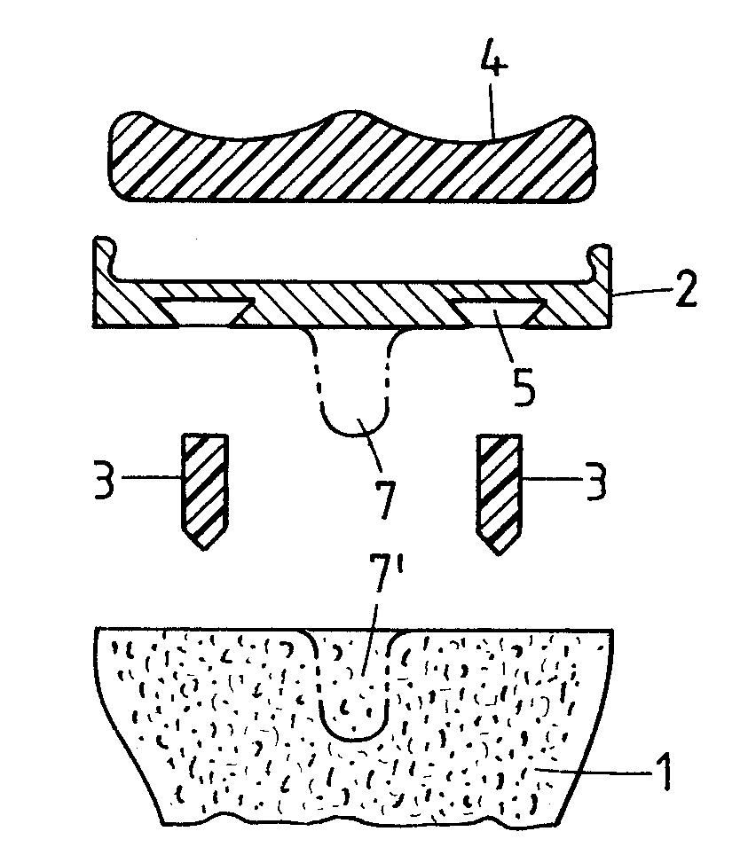 Method for fastening an implant to bone tissue and corresponding implant system