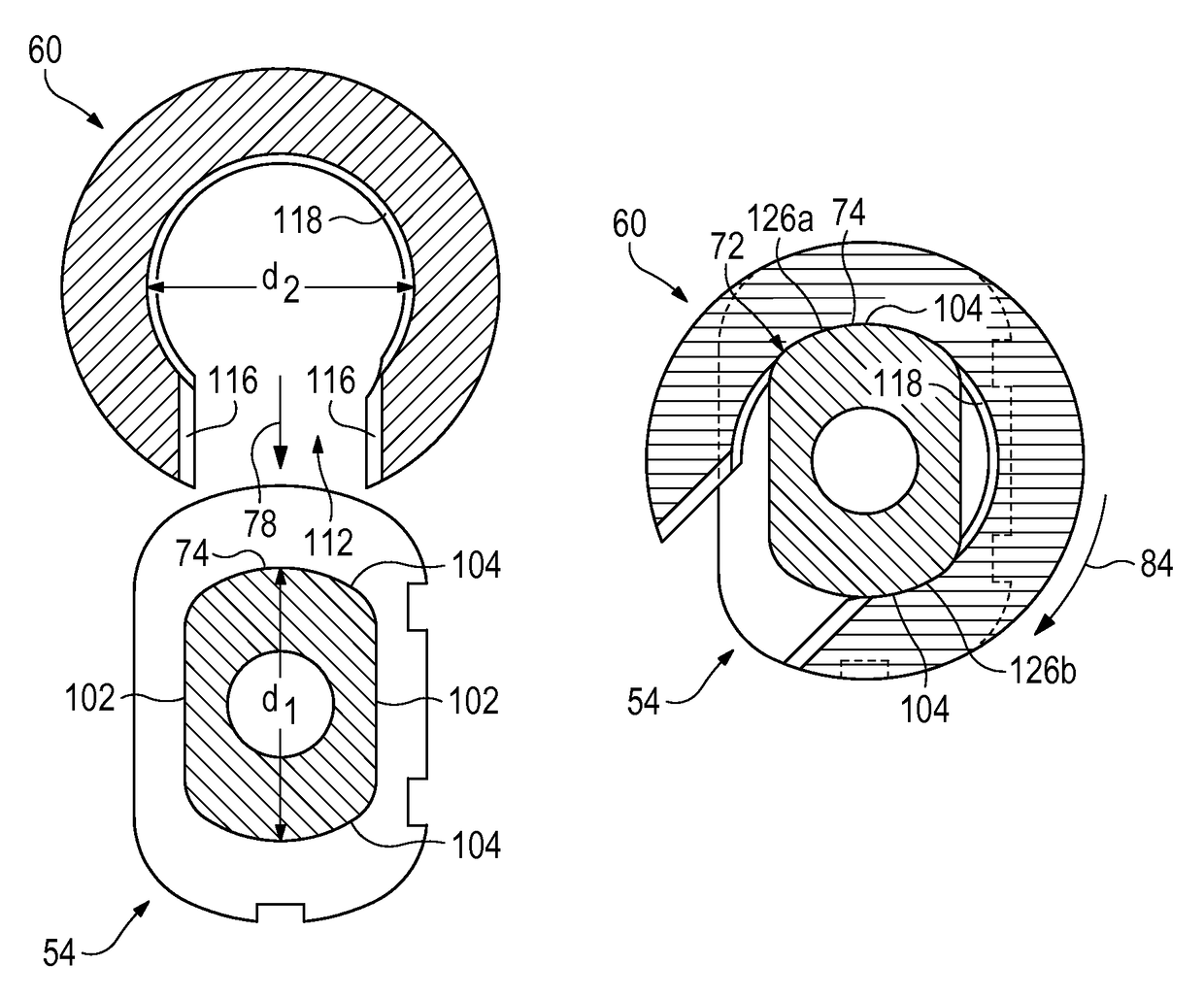 Radial head prosthesis with rotate-to-lock interface