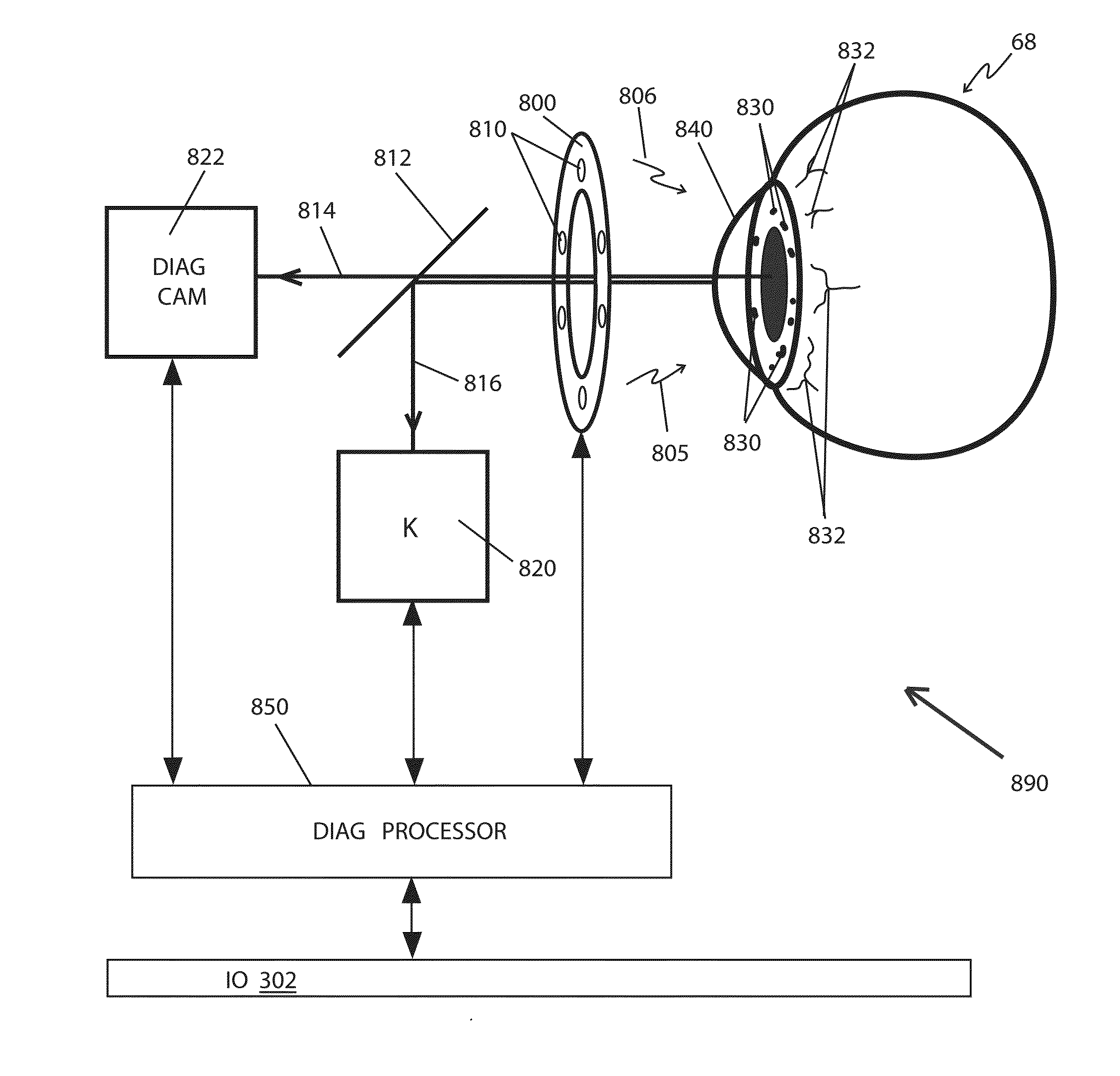 Method for Alignment of Intraocular Lens