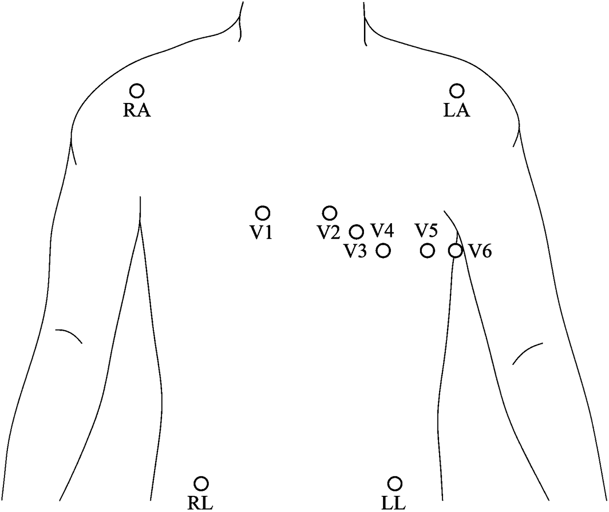 Electrocardiogram electrode positioning assistive device and method for locating electrocardiogram patch position by assistive device