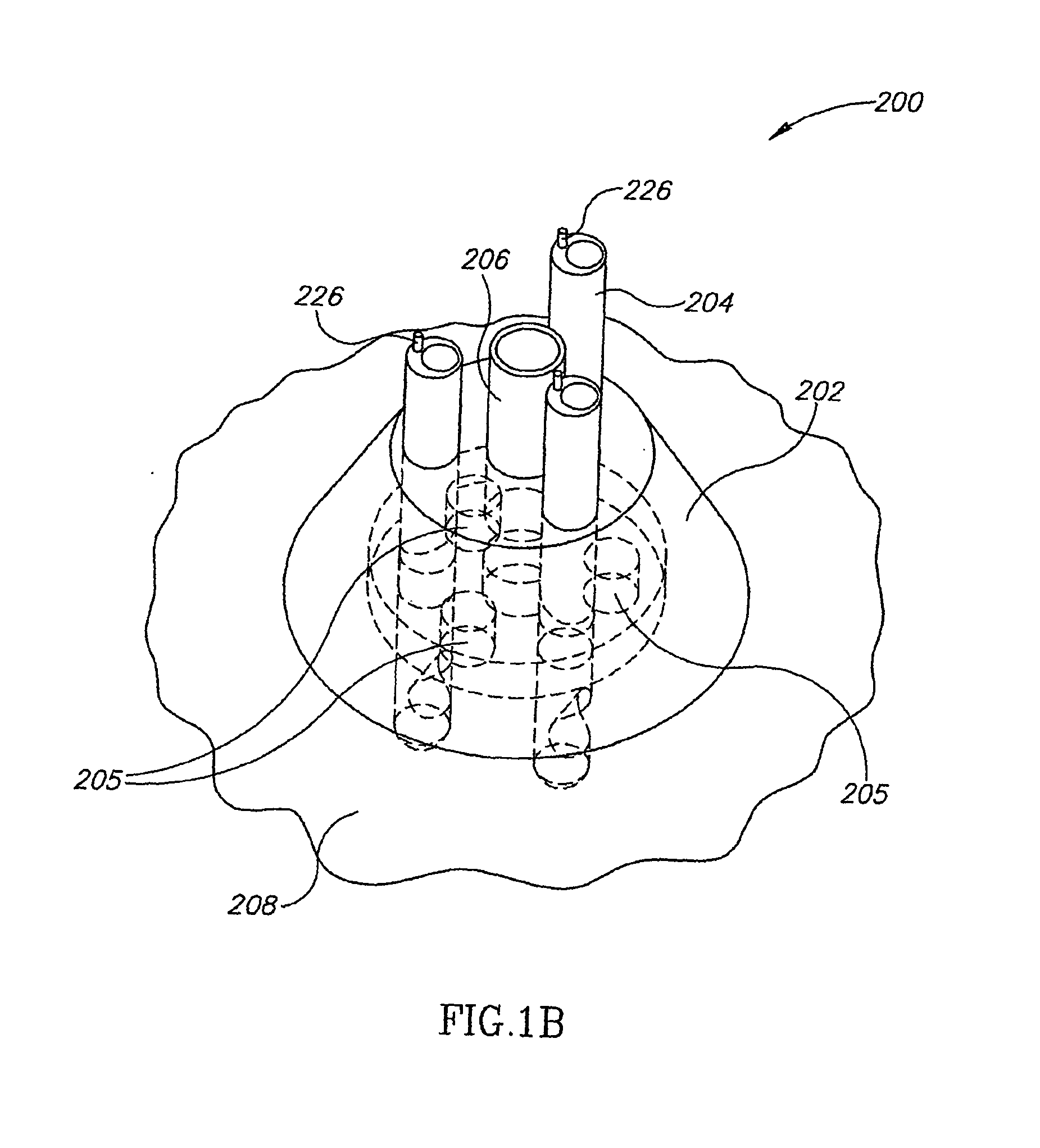 Apparatus and methods for enzymatic debridement of skin lesions