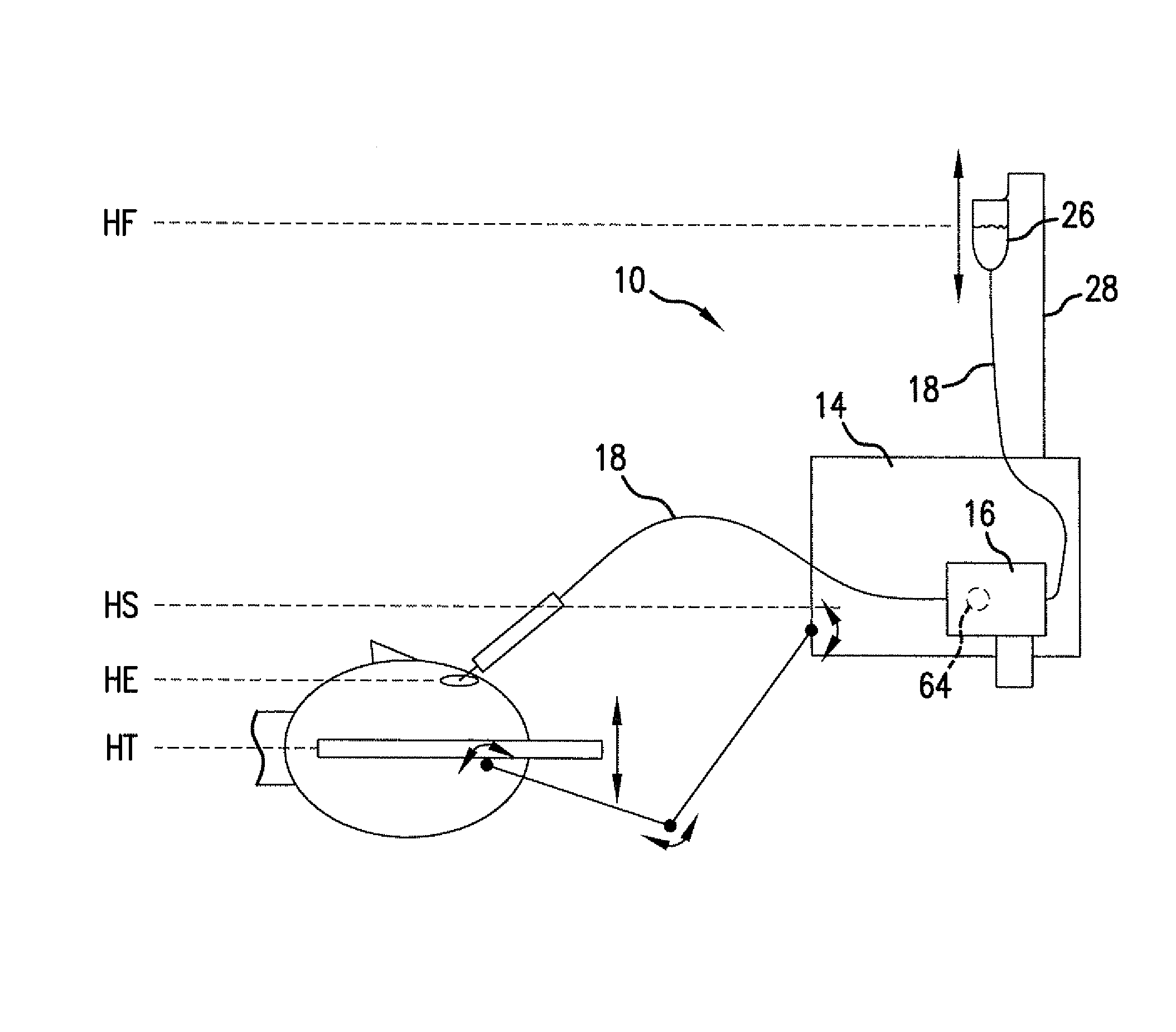 Reversible peristaltic pump and other structures for reflux in eye surgery