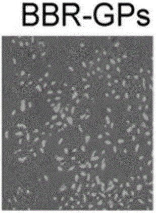 Berberine-glucan microcapsule as well as preparation method and application thereof