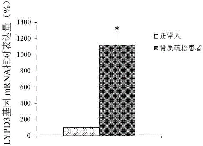 Molecular marker for osteoporosis and application of marker