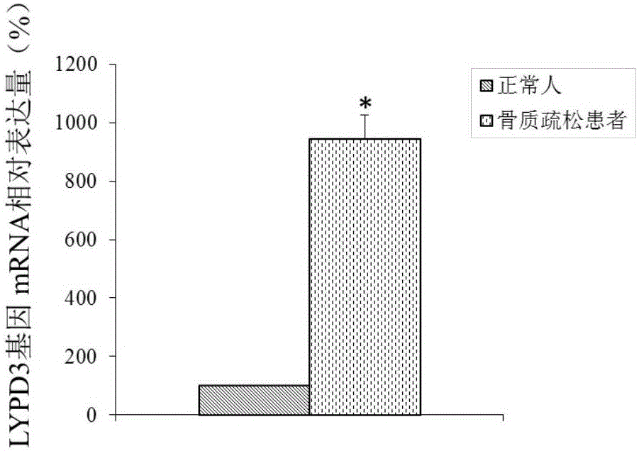 Molecular marker for osteoporosis and application of marker