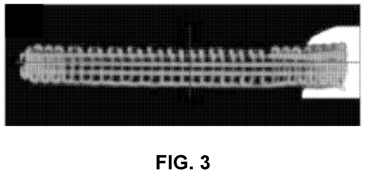 Customized load-bearing and bioactive functionally-graded implant for treatment of osteonecrosis