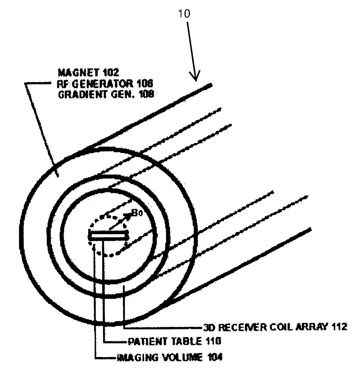 Ultrafast MRI system and method