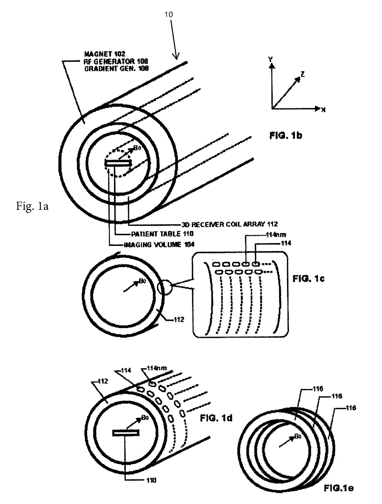 Ultrafast MRI system and method