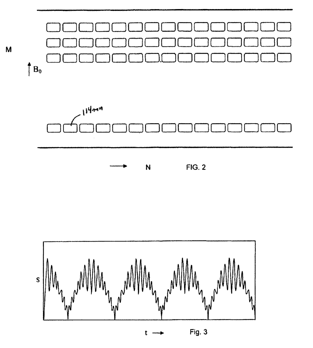 Ultrafast MRI system and method