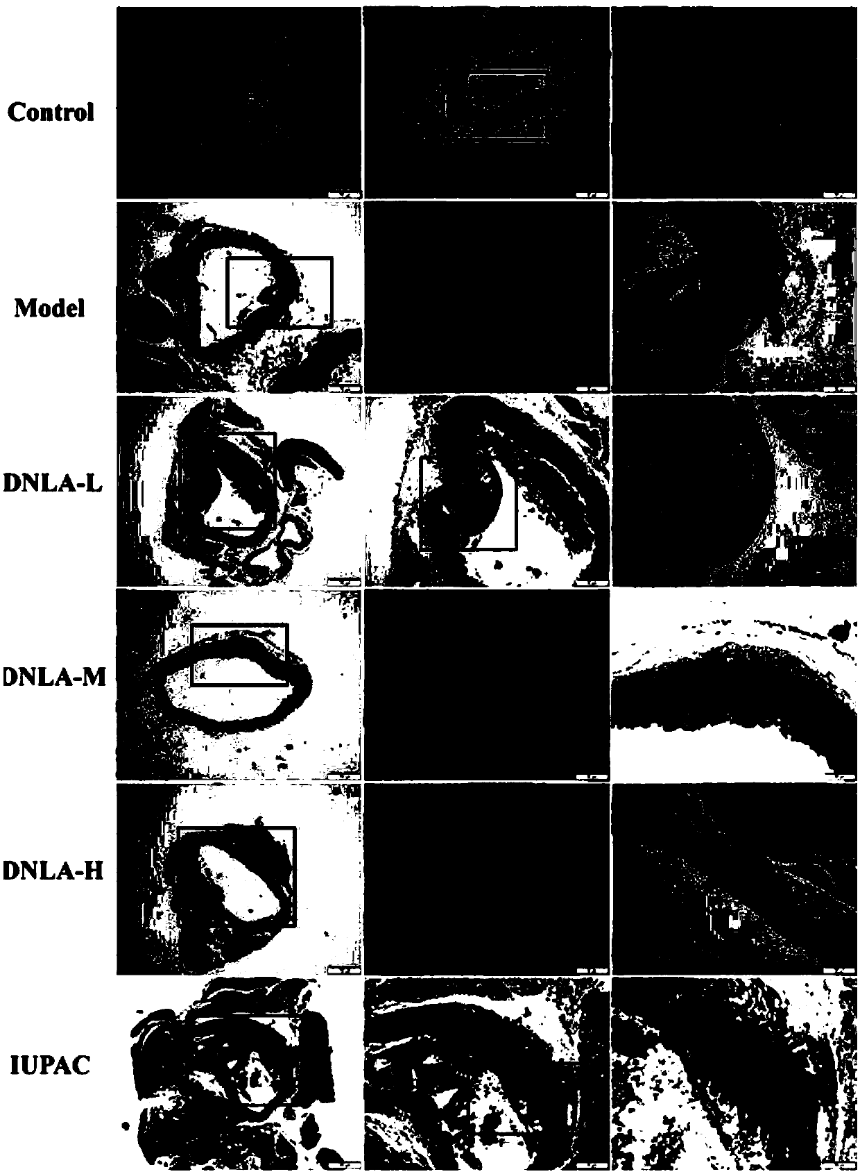 Application of noble dendrobium total alkali in preparing drug for atherosclerosis