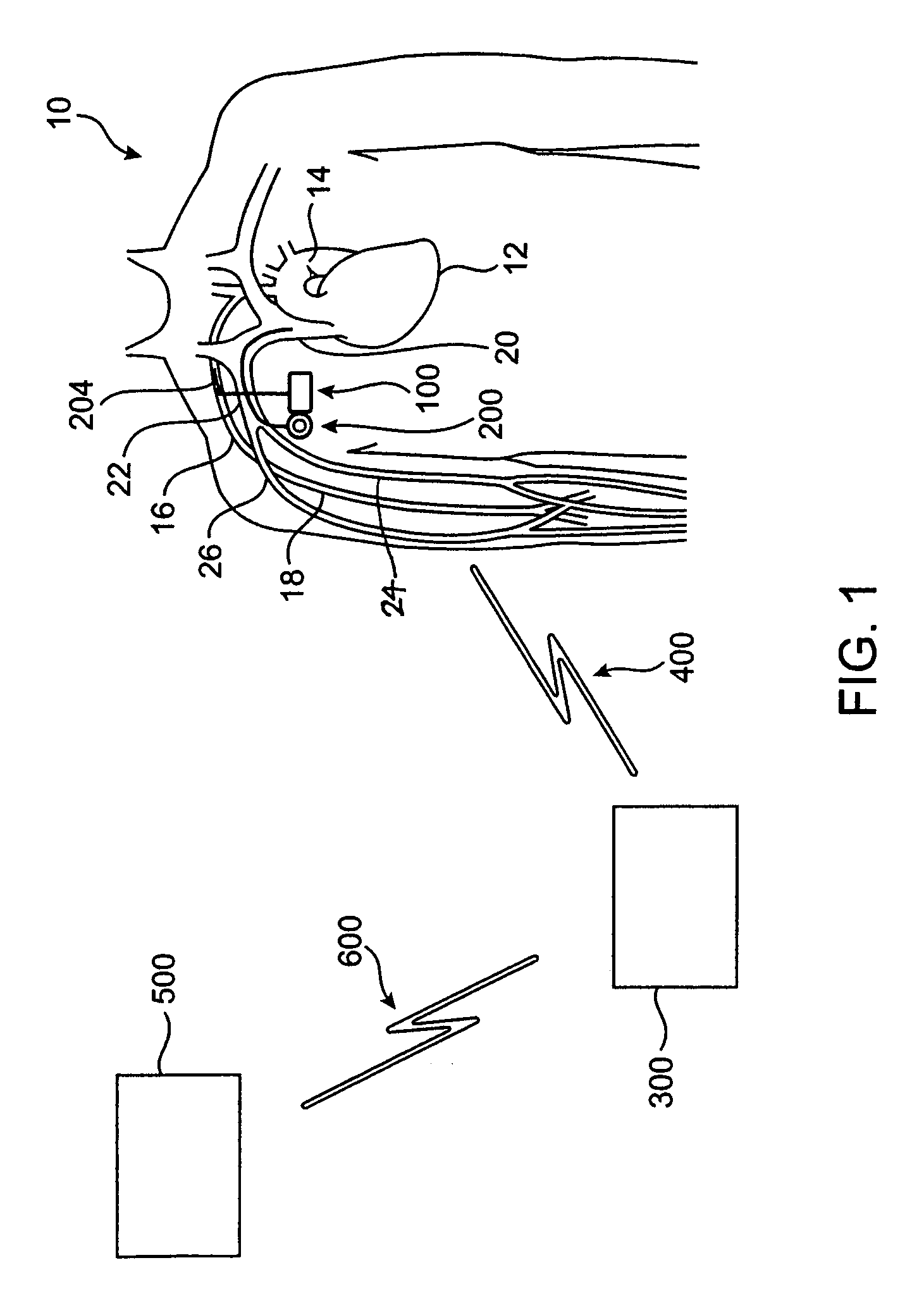 Vascular access port with physiological sensor