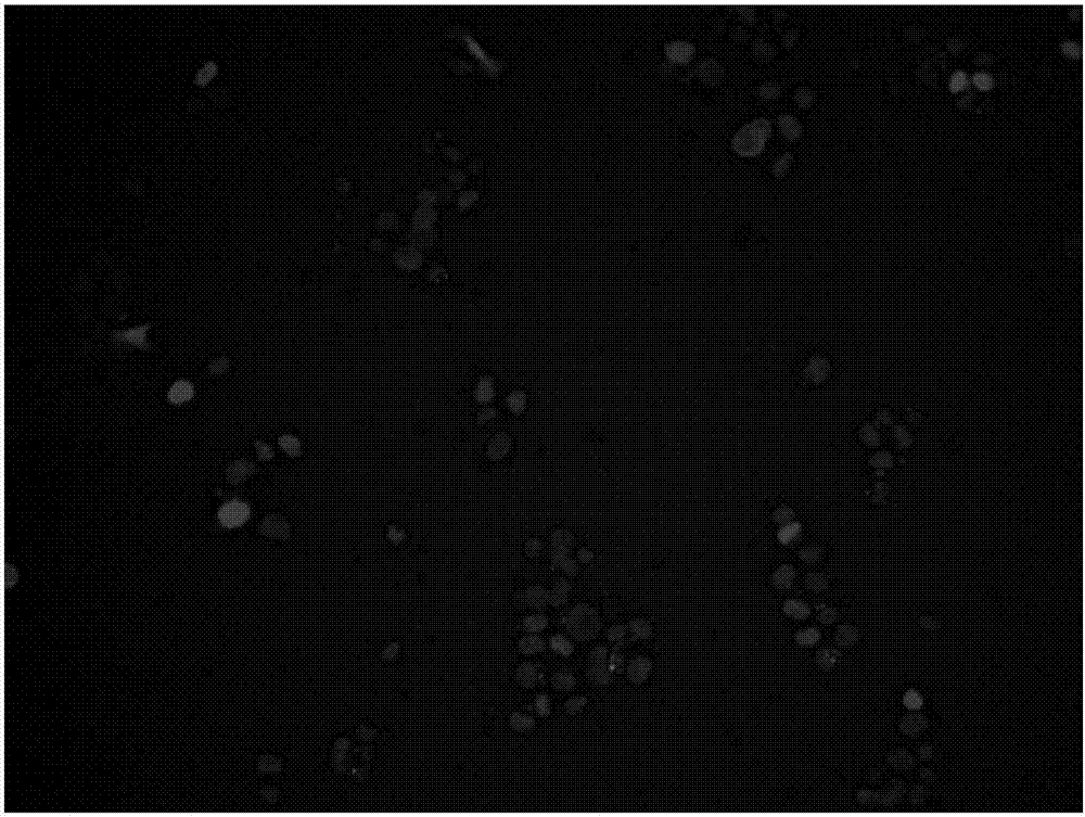 Liver cancer detection kit based on liquid biopsy