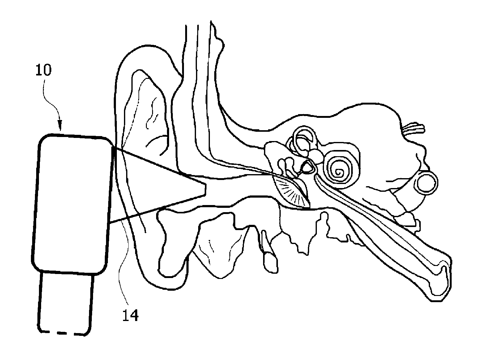 Probe for diagnosing otitis media using terahertz waves and otitis media diagnosis system and method