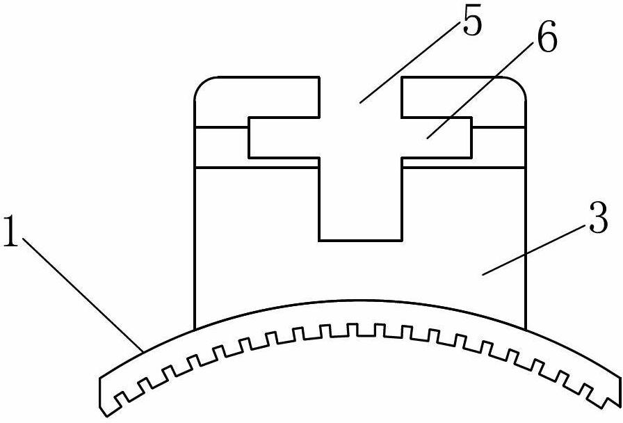 Dental orthodontic self-locking supporting groove