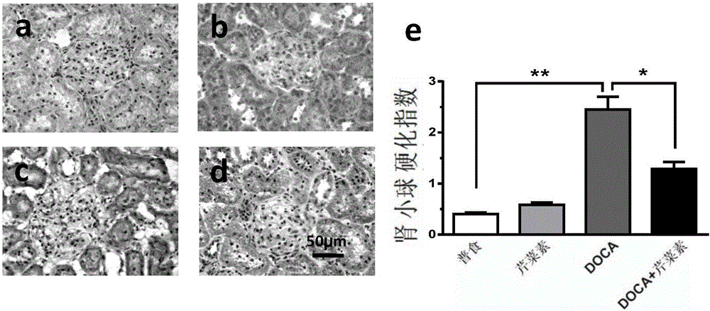 Application of apigenin in preparation of drugs for preventing and treating renal fibrosis