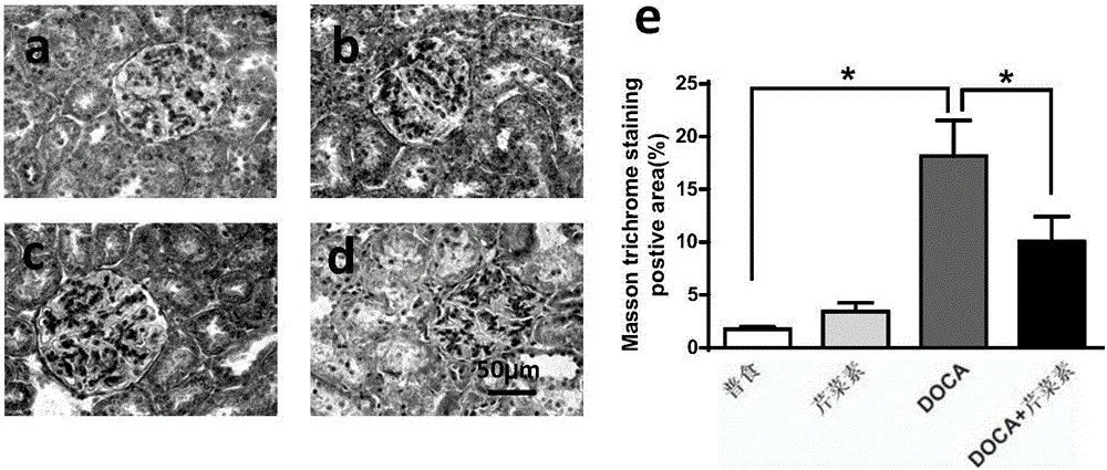 Application of apigenin in preparation of drugs for preventing and treating renal fibrosis