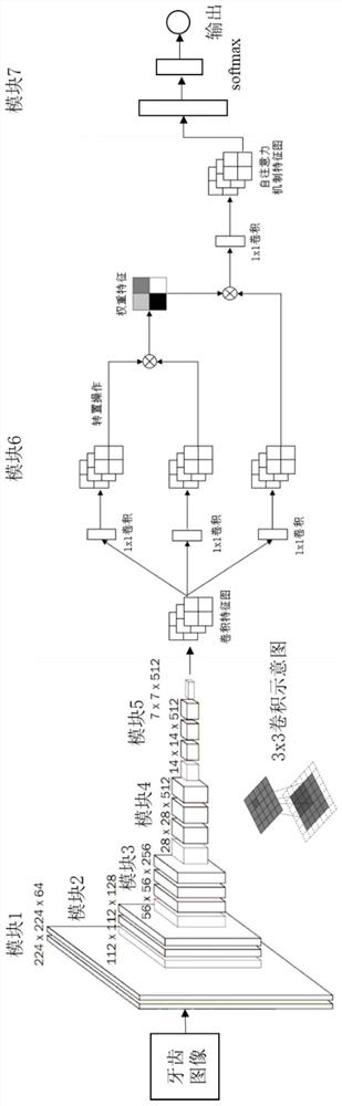 Tooth image caries identification method and system based on convolutional neural network